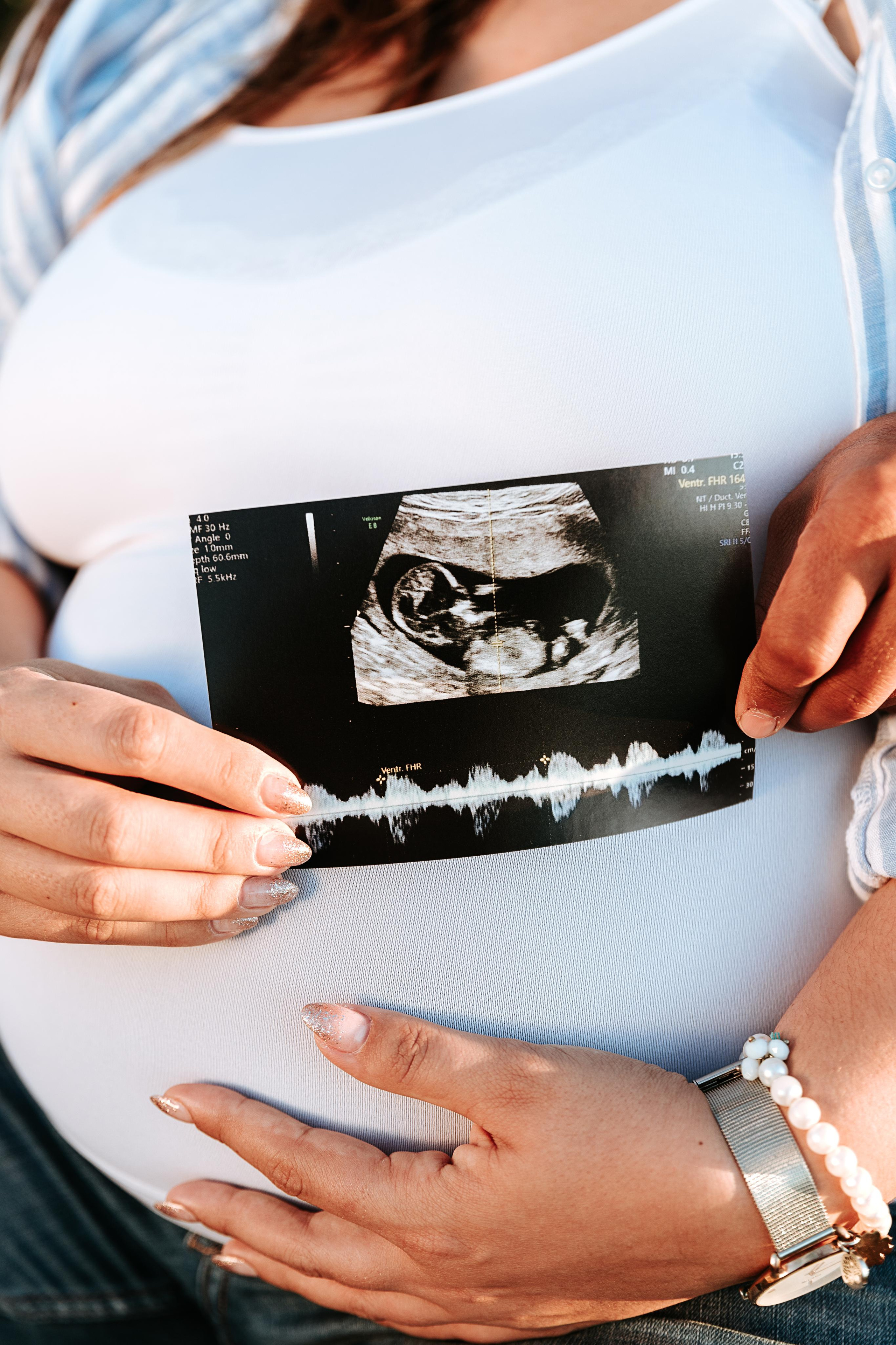 Sessão Maternidade. Fotografia e Filmes de Casamento de Luxo | Portugal & Destination Weddings | Ricardo & Mary Pictures