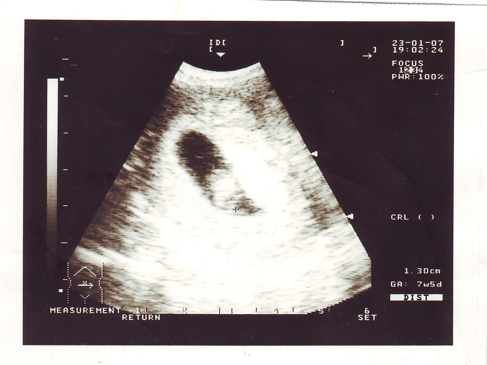 Фотопроект "Маятник" о родительском выгорании. Фотограф Анна Резников