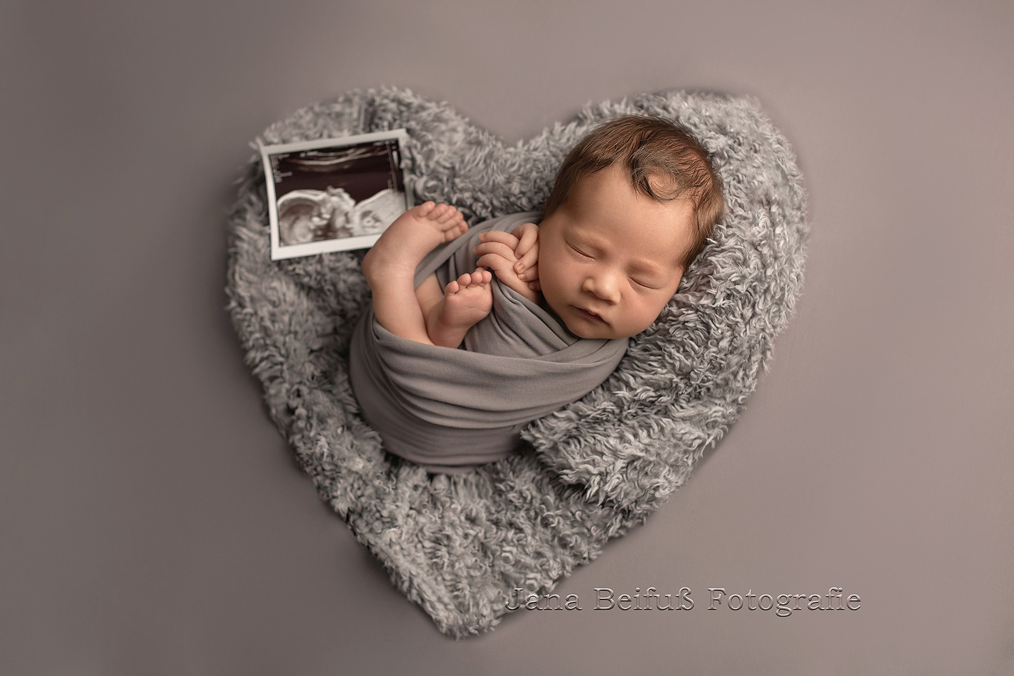 Neugeborenenshooting Weißenhorn, Baby Shooting Weißenhorn, Babyshooting, Babyfotograf Weißenhorn, Neugeborenenshooting Ulm, Babyfotograf Ulm, Babyfotograf Senden, Babyfotograf Neu-Ulm, Jana Beifuß Fotografie, Familienfotos, Liebe, Geduld, Neugeborenenfotos weissenhorn, Pfaffenhofen a. d. Roth, Gaumenspalte, Gaumenlippenspalte