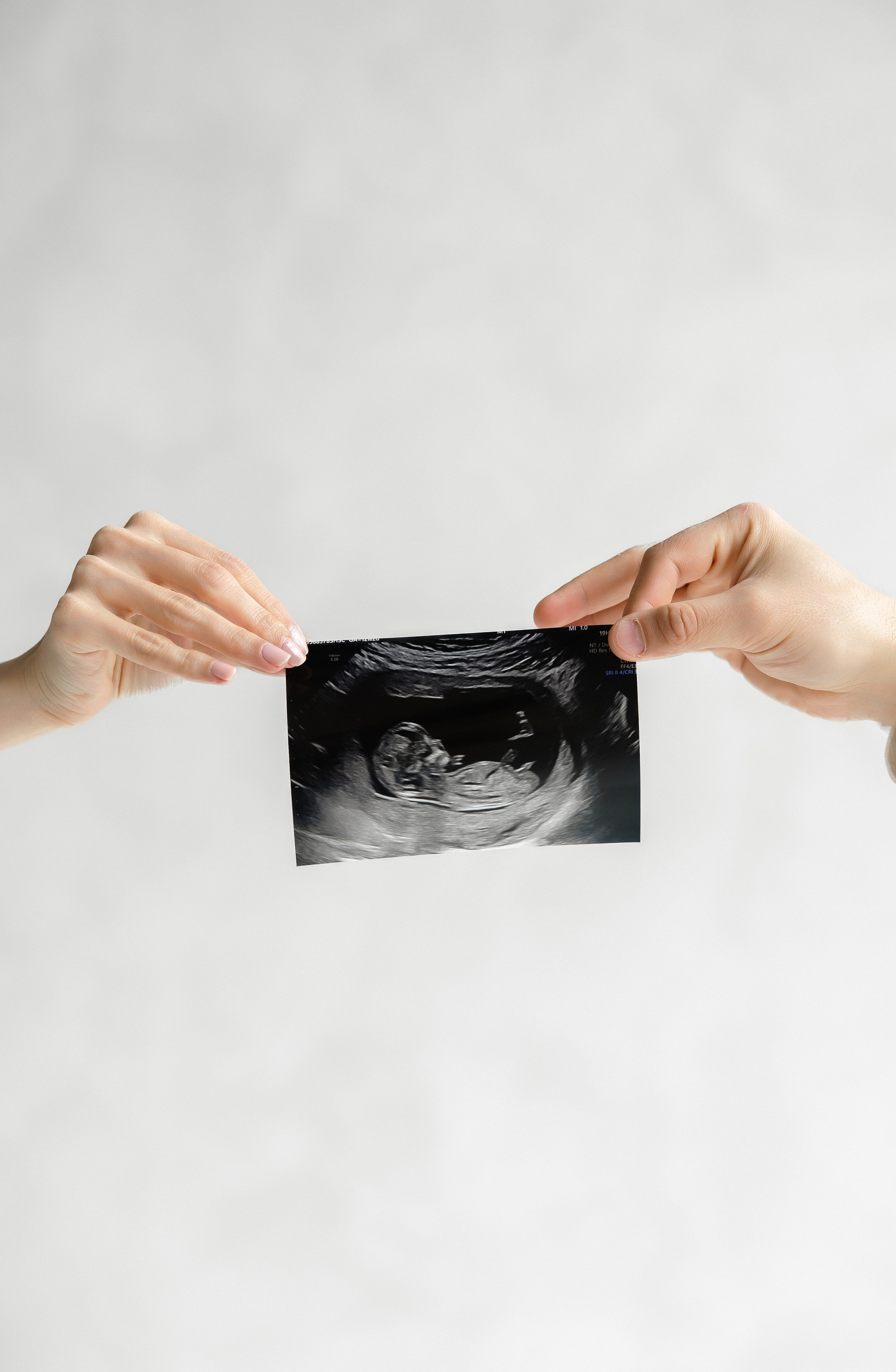 Close-up of hands holding baby ultrasound photo during maternity photoshoot – modern, minimalistic pregnancy photography in Toronto by Iana Banana