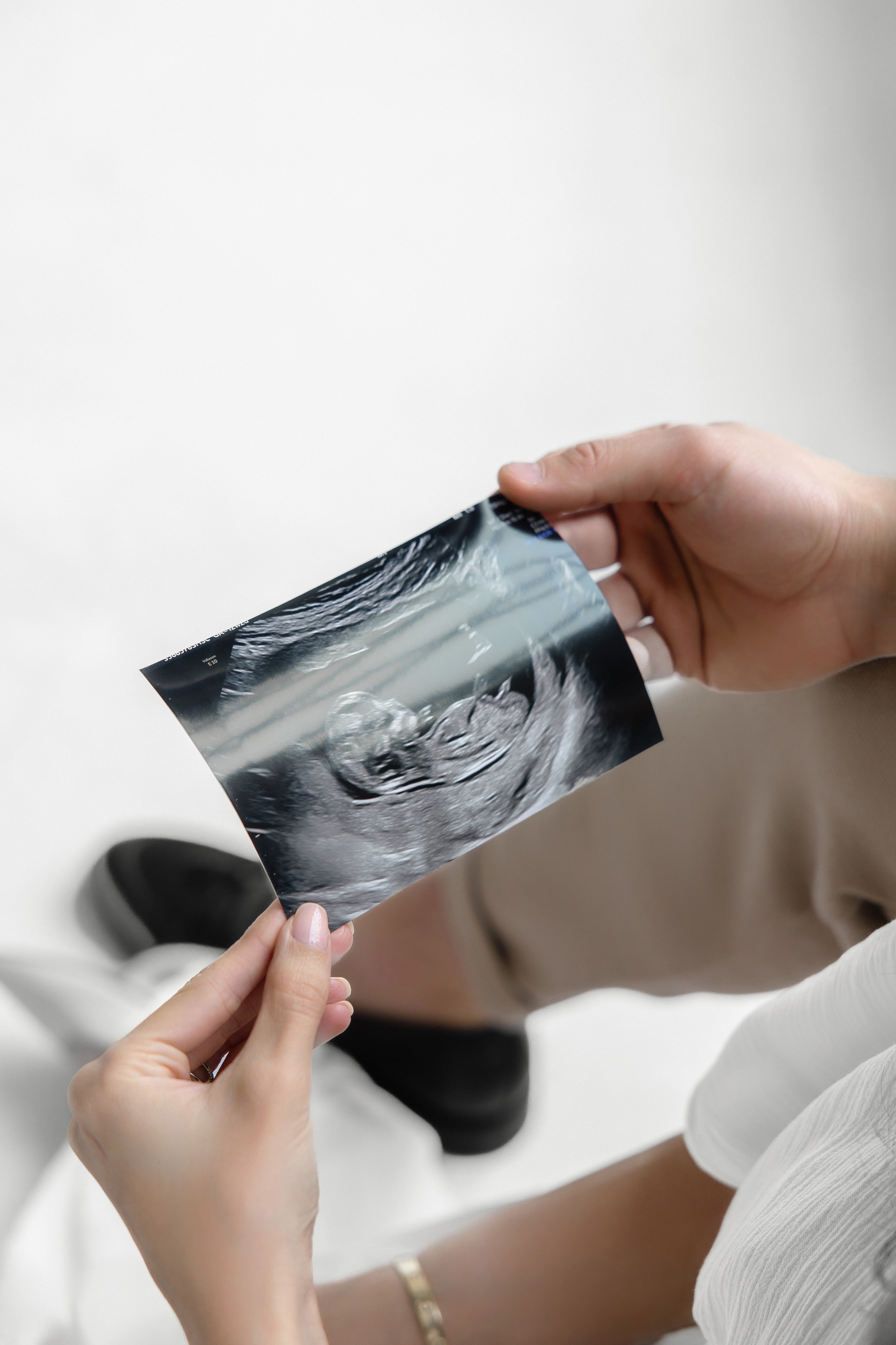 Close-up of couple holding baby ultrasound photo during maternity session – intimate, emotional pregnancy photography in Toronto by Iana Banana
