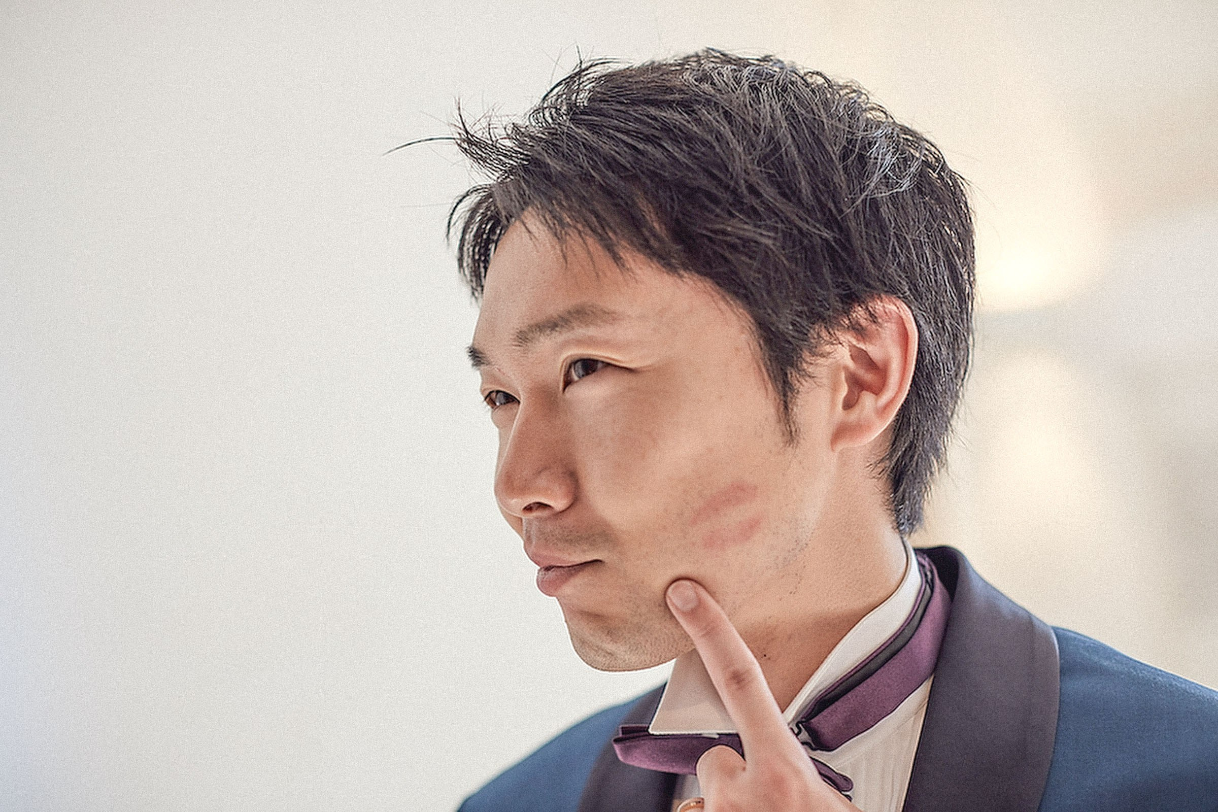 A Japanese groom points to the outline of his bride's lipstick after she kissed him on the cheek.