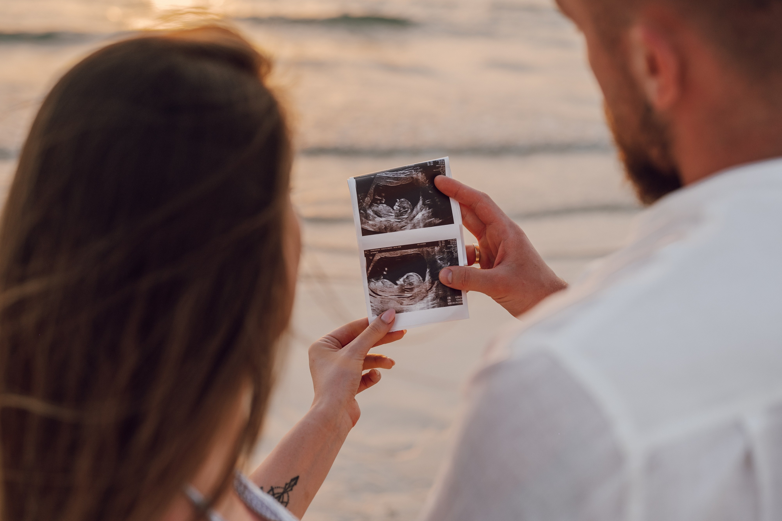 Para trzymająca zdjęcie USG – sesja ciążowa lifestyle, fotograf rodzinny z Poznania