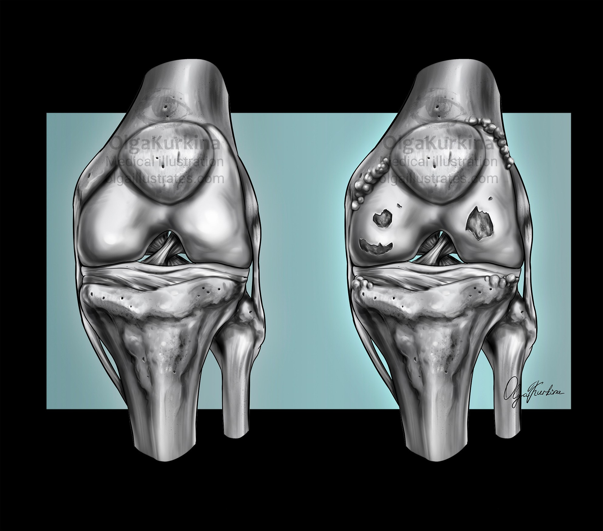 Professional freelance medical illustrator