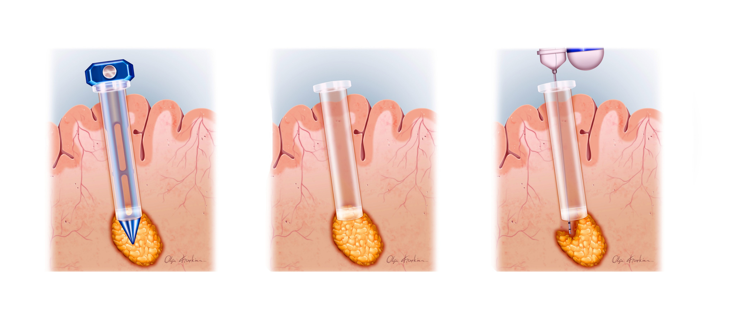 Professional freelance medical illustrator