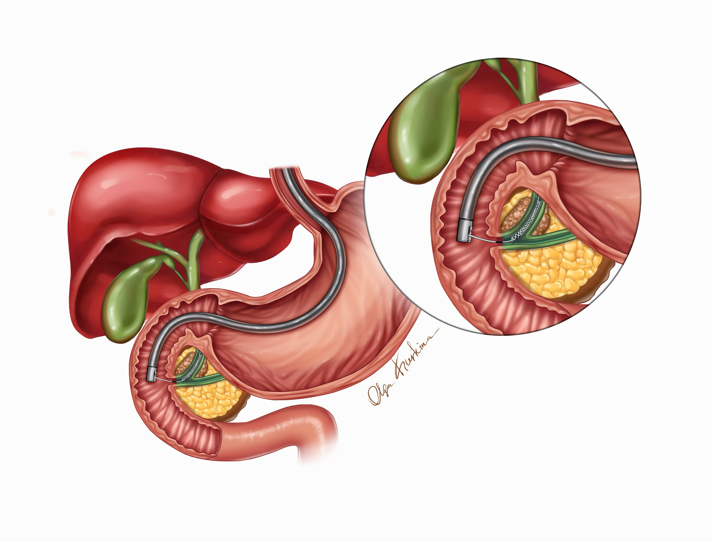 Professional freelance medical illustrator