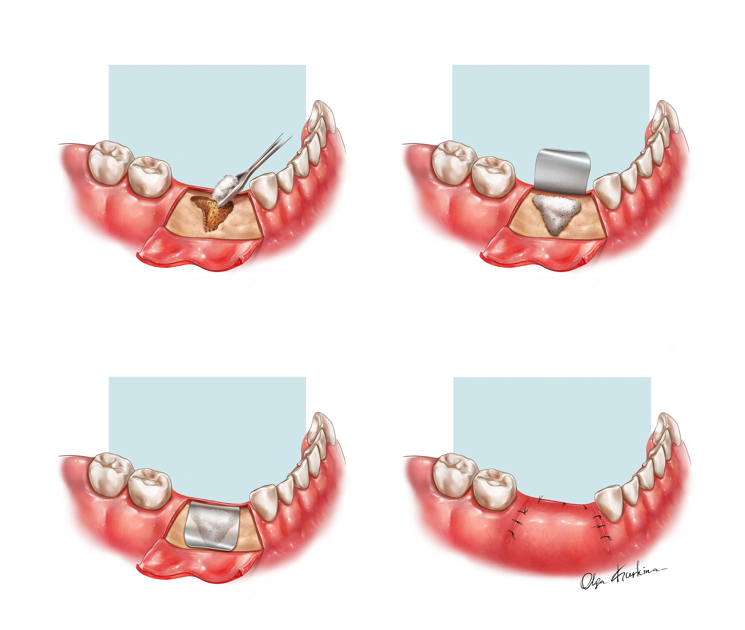 Professional freelance medical illustrator