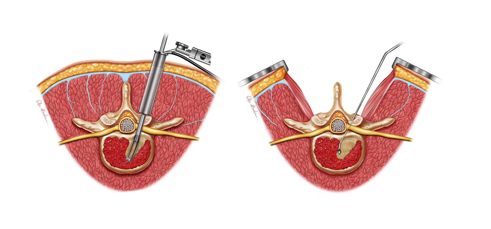 Professional freelance medical illustrator