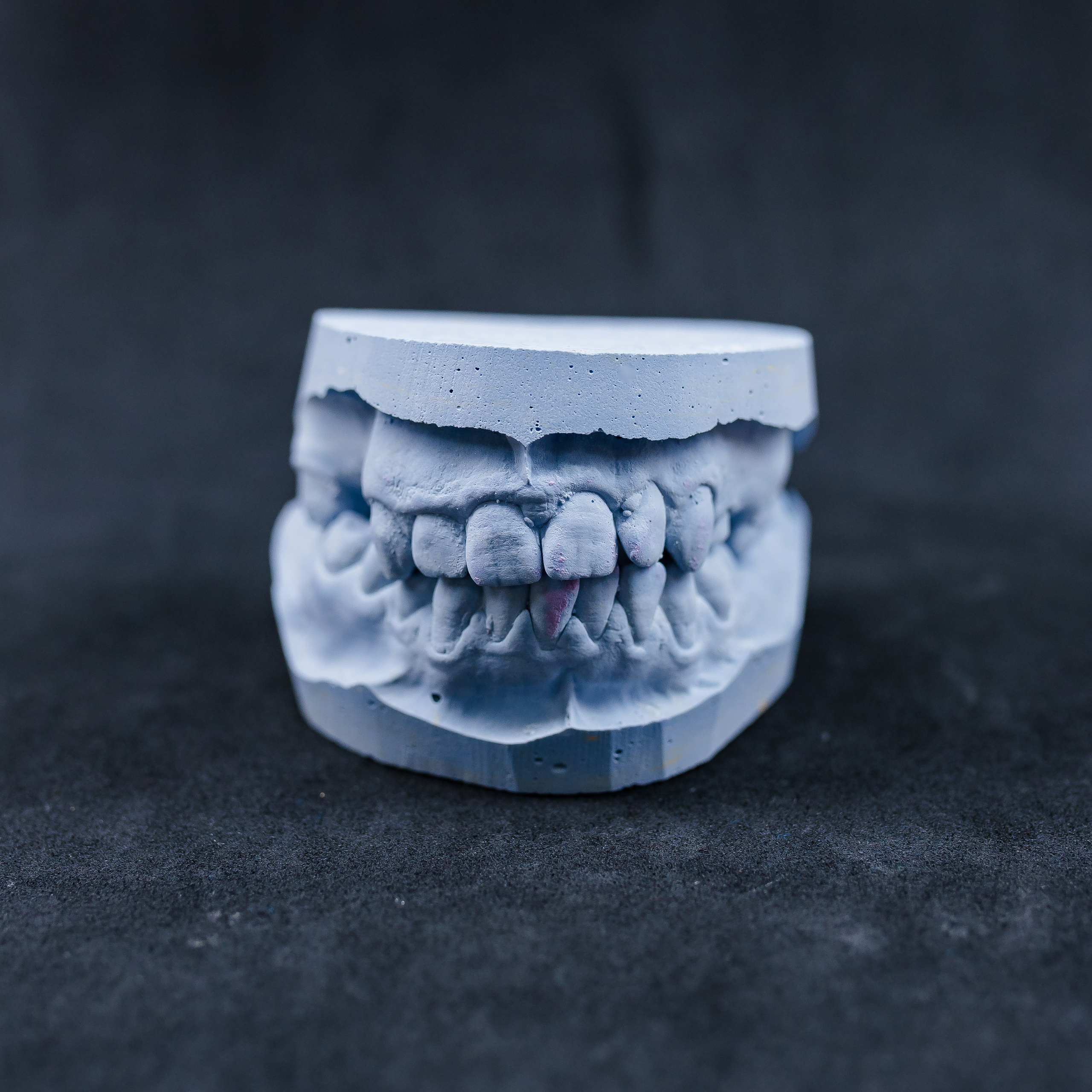 Dentistry. Wedding Photographer New York