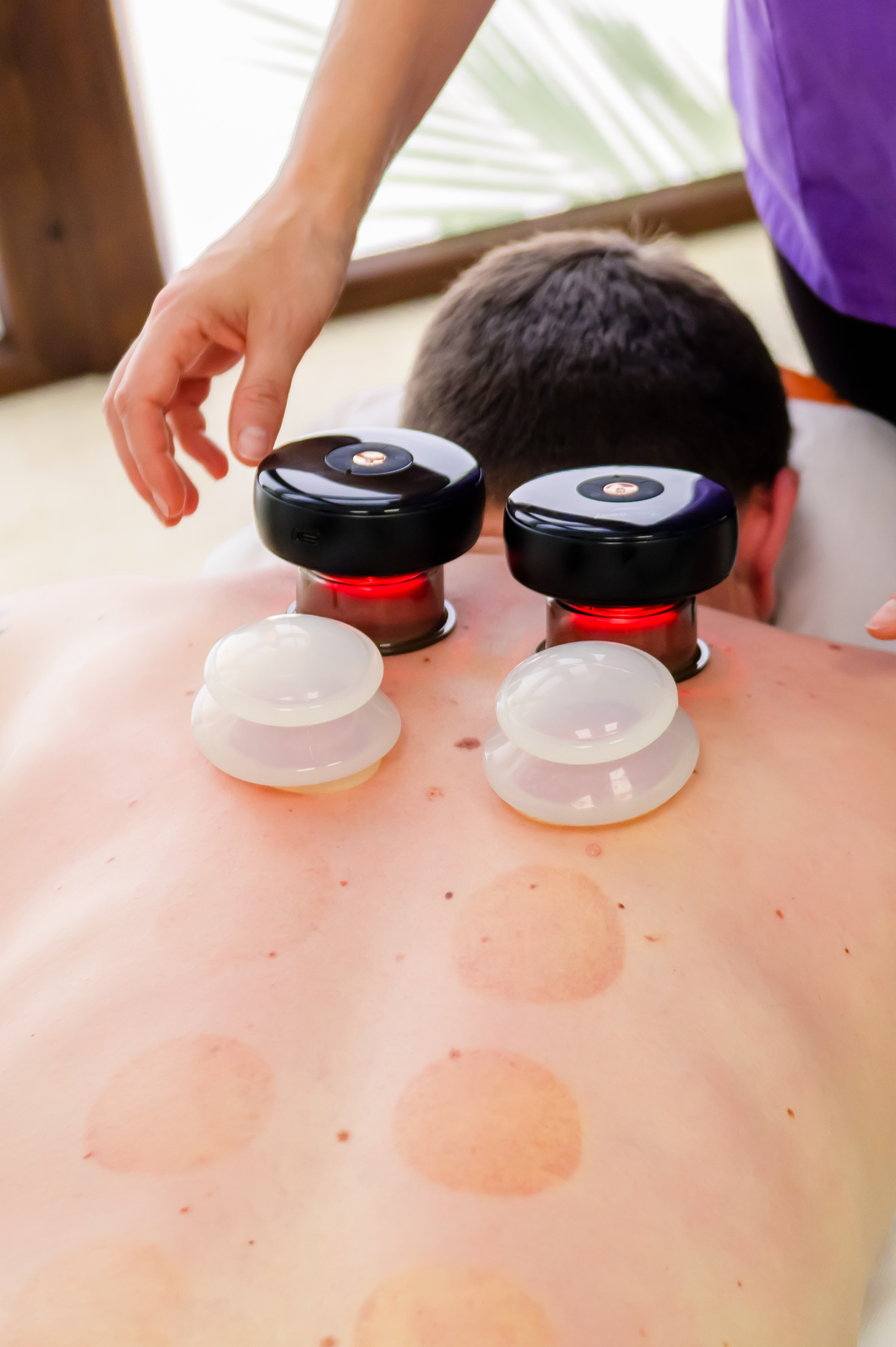 Ventuzoterapie. Newsportevents- Recuperare & Relaxare, Kinetoterapie, Masaj, Refacere, Stretching, Osteopatie, Recuperare, Tecar