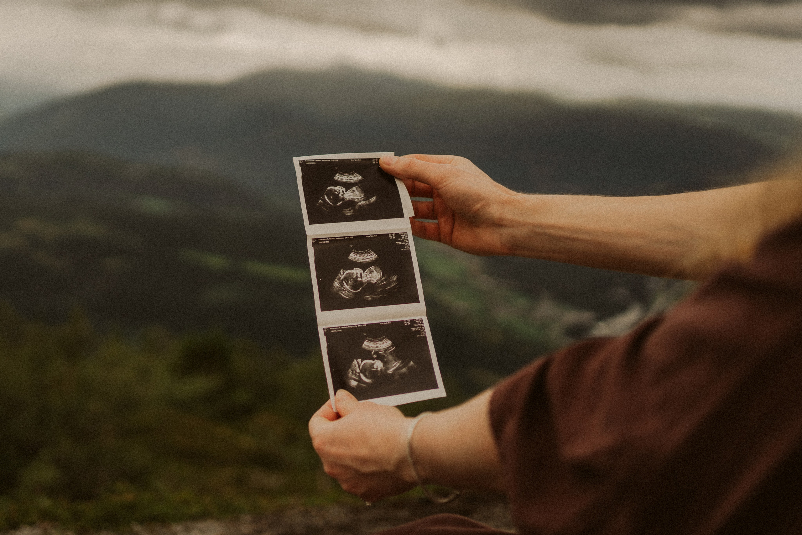 Sesja ciążowa w Norwegii | Plener w Voss pełen ciszy i natury. Fotograf ślubny Śląsk – reportaż ślubny | KarkowskaFoto