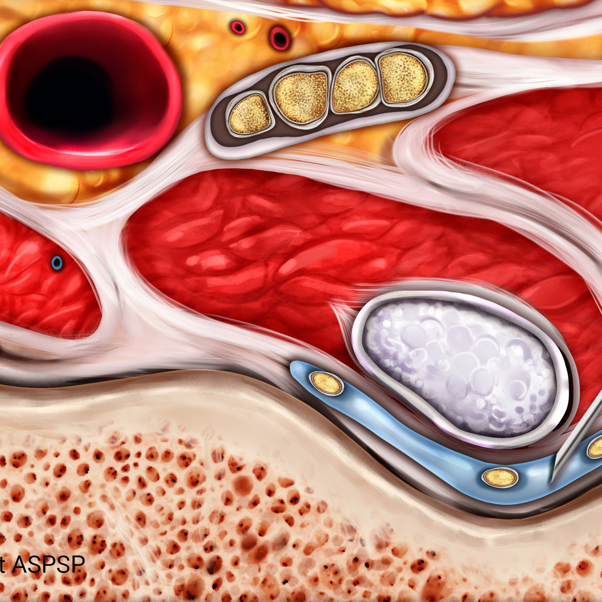 Professional freelance medical illustrator