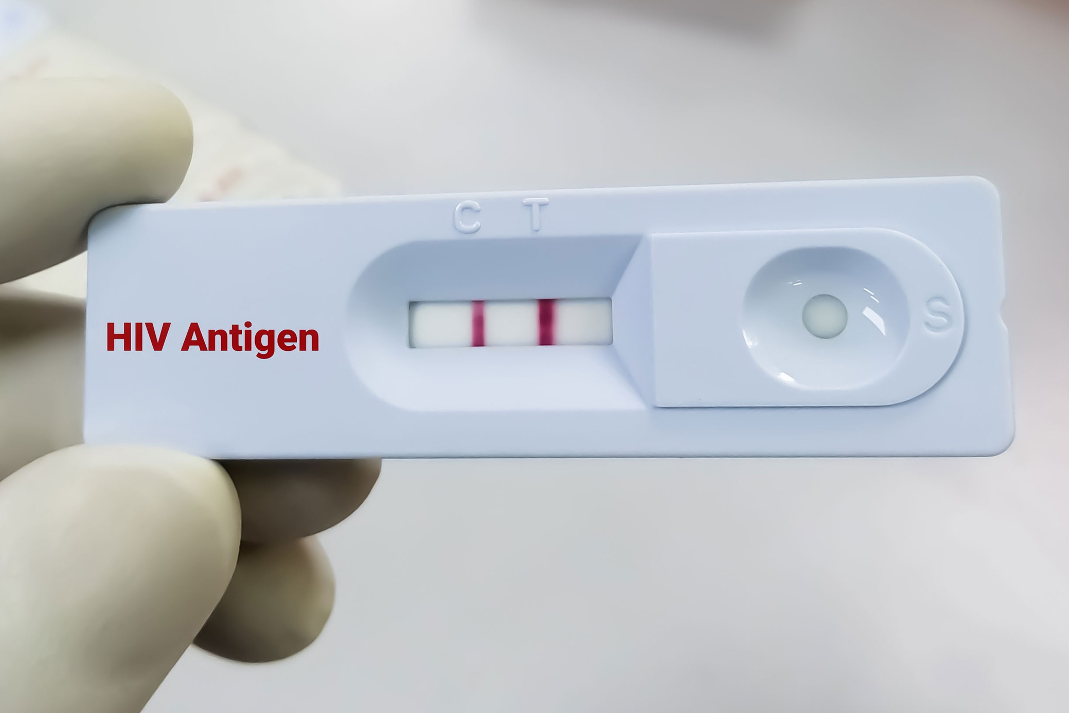 HIV-kiirtestimise ja ravisoostumuse teenused Eestis