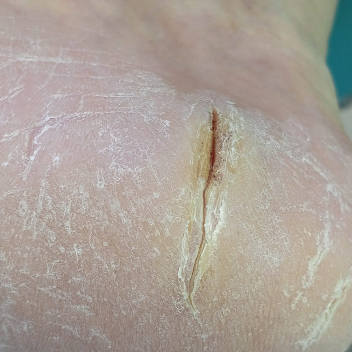 Услуги. ЦЕНТР ЗДОРОВОЙ СТОПЫ «ОКСИМА» Солнечногорск, Красноармейская, 10а, 2 э