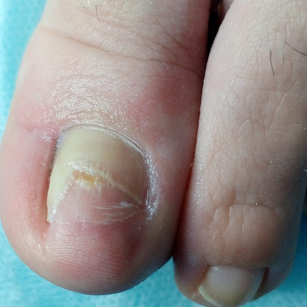 Услуги. ЦЕНТР ЗДОРОВОЙ СТОПЫ «ОКСИМА» Солнечногорск, Красноармейская, 10а, 2 э