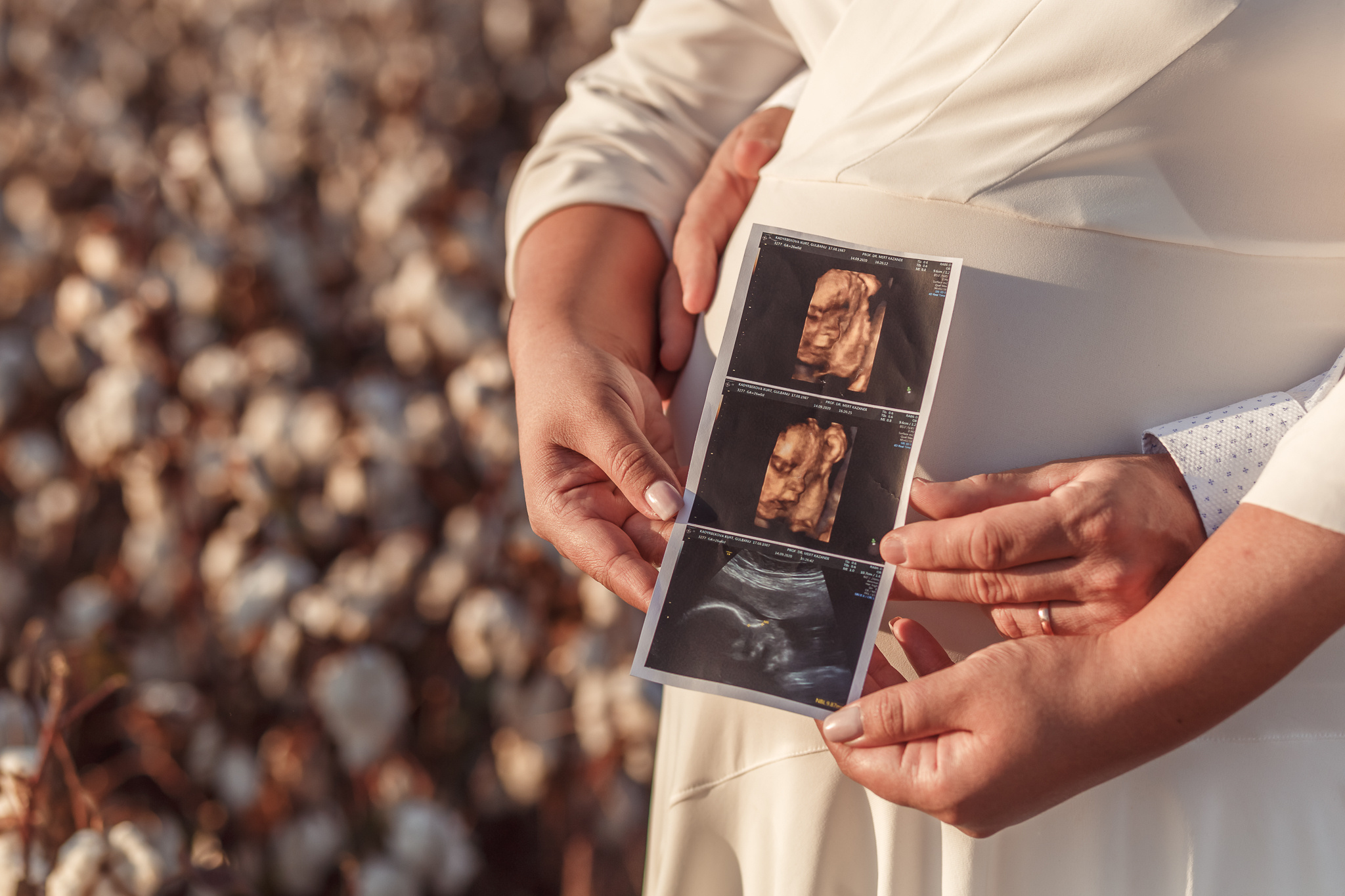 Gulbanu&Fatih. Waiting for a miracle