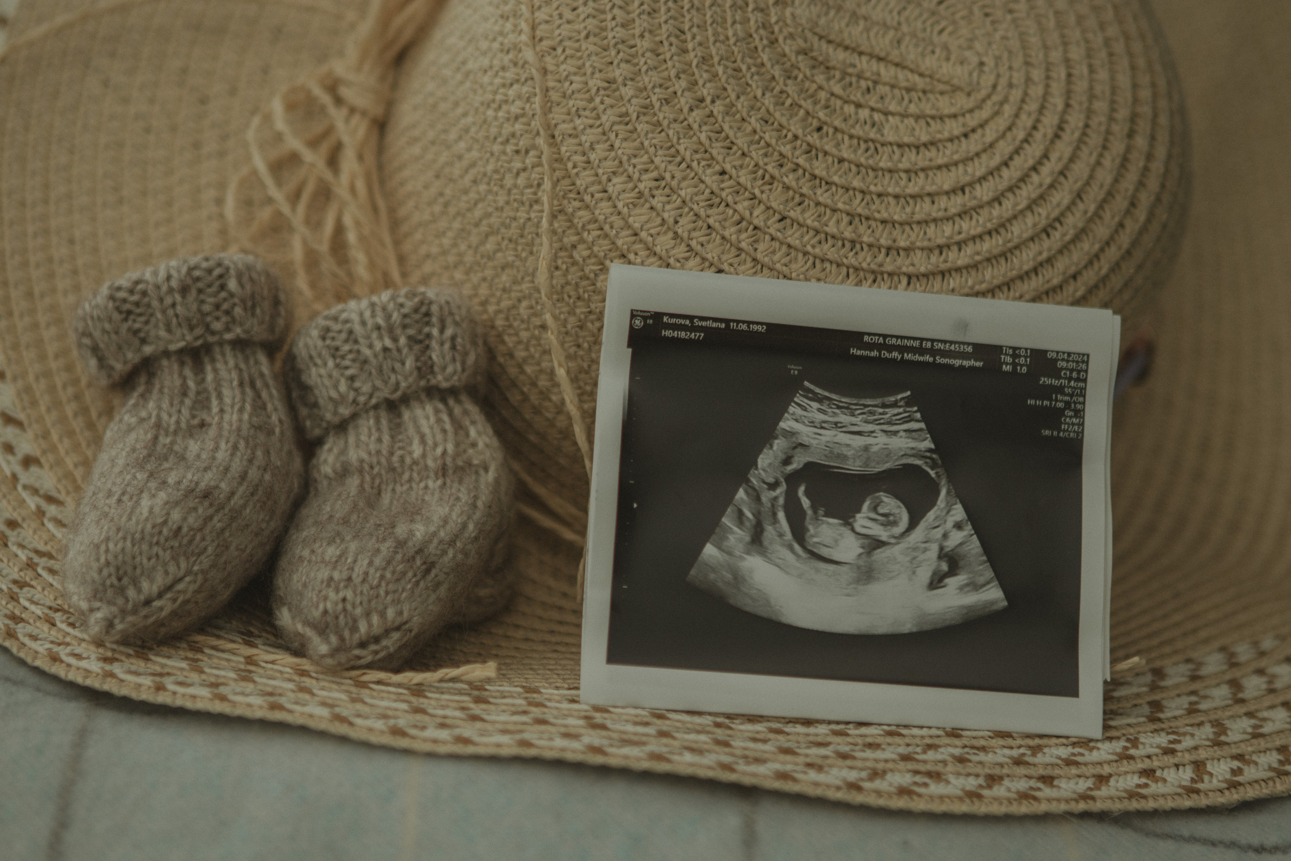 Expecting Pregnancy. Photographer Margarita Antonova in Naas, Co Kildare