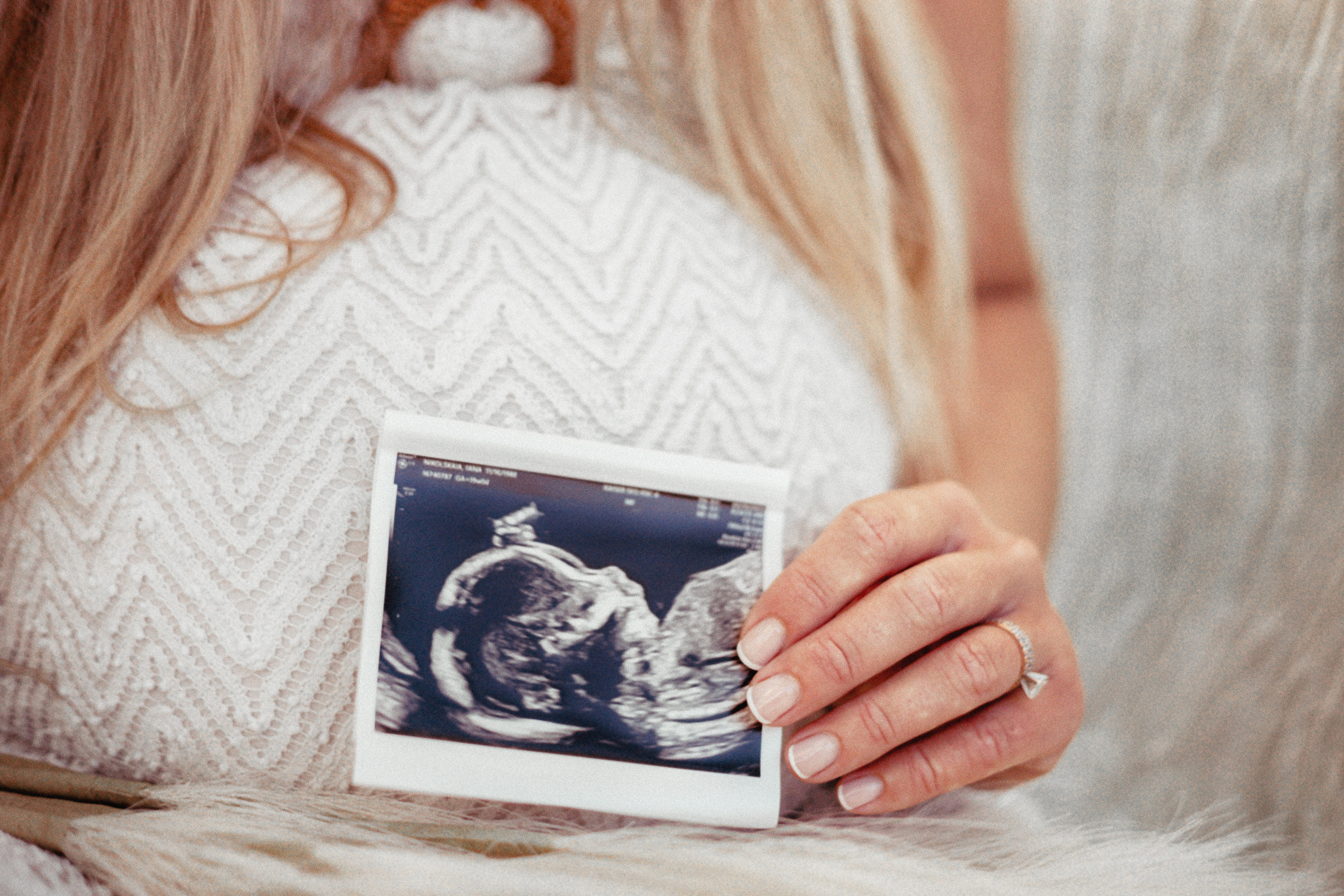 Pregnancy photo shoot in the park. Bay Area Photographer: family, maternity, love story, wedding