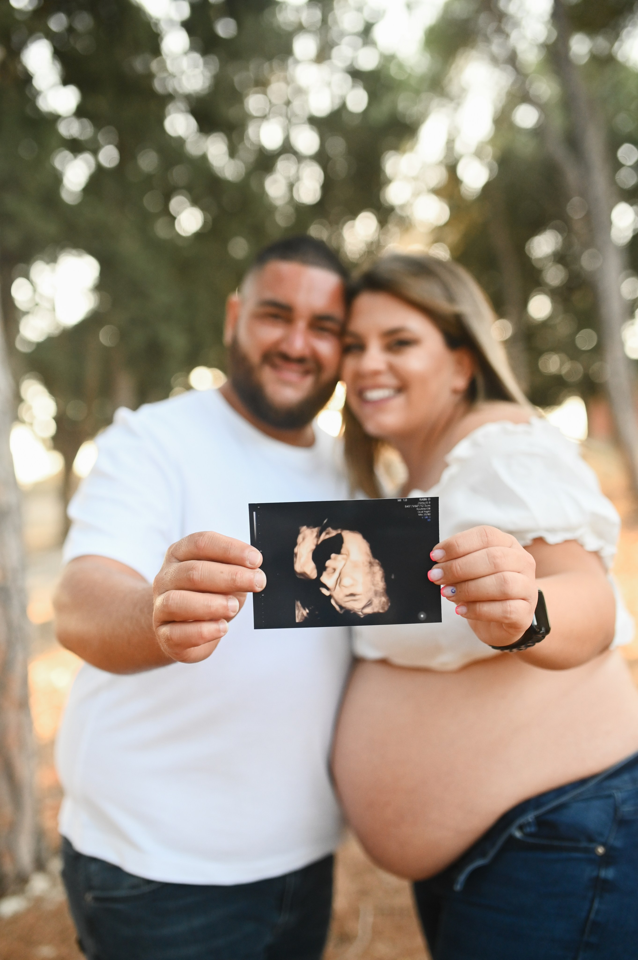 Φωτογράφιση εγκυμοσύνης στο Φιλέρημο Ρόδου – Μαγικές στιγμές μέσα στη φύση. WELCOME