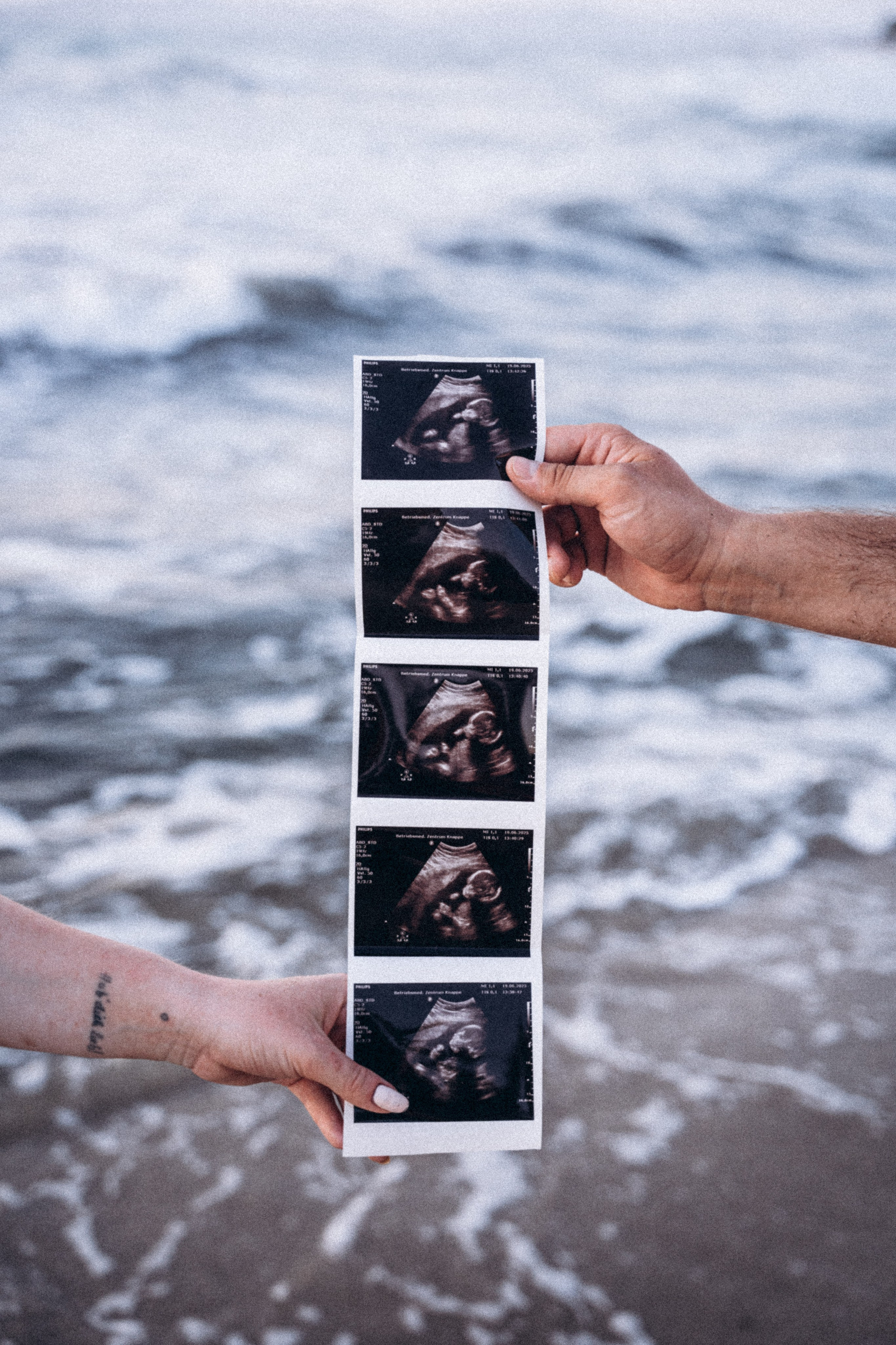 Семейная фотосессия на острове Кос. Anita_photo
