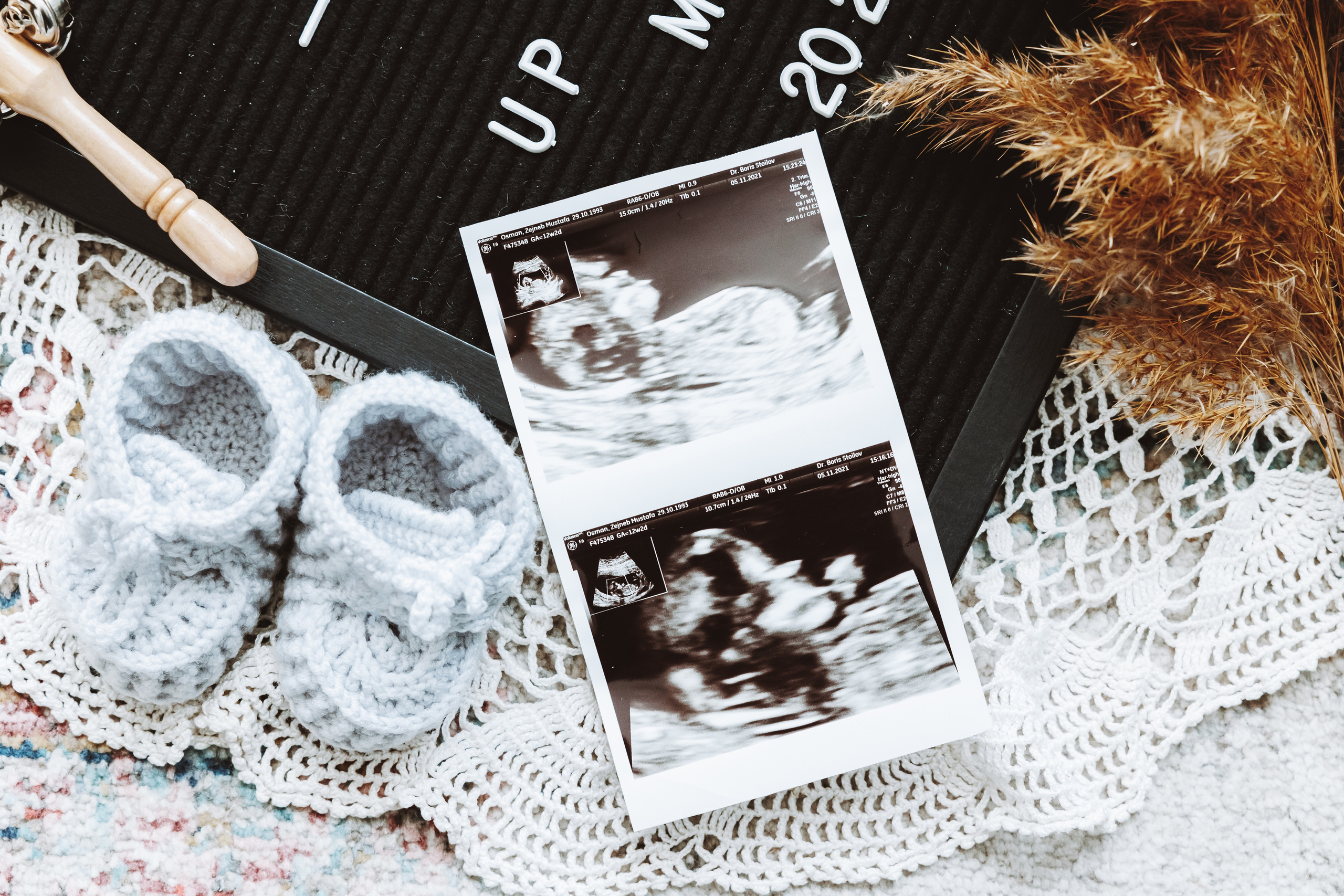 Бременна Фотосесия. Фотограф Ирина Йотова