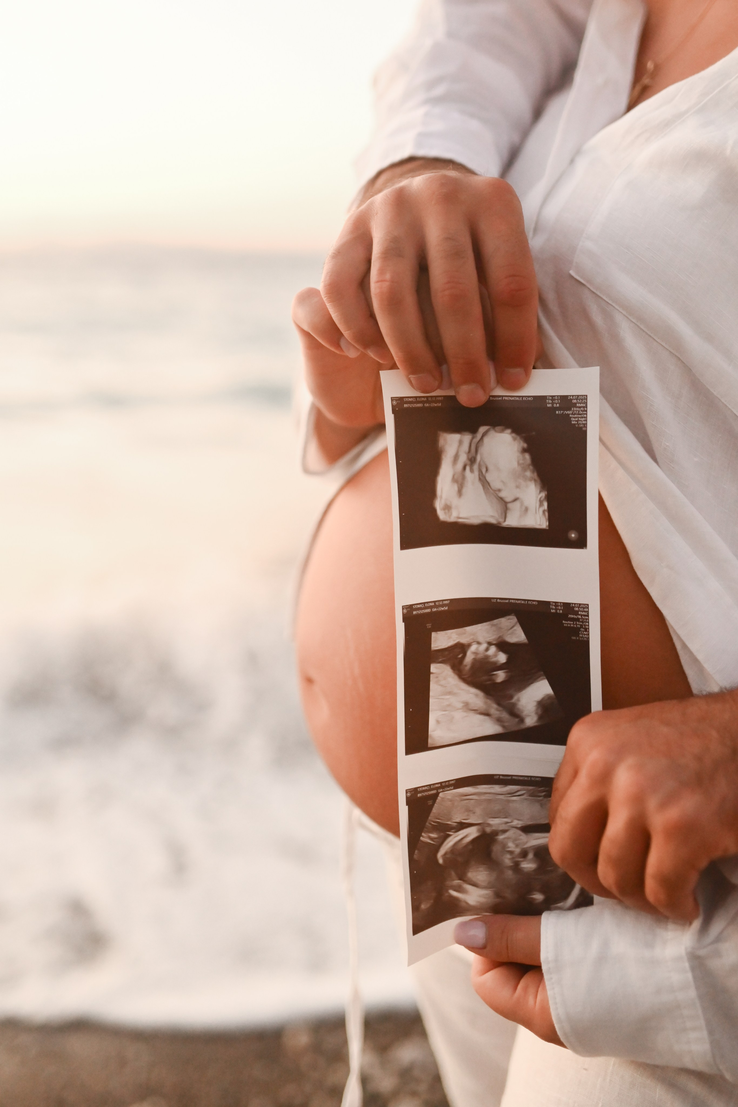 Romantic Beach Photoshoot in Rhodes — Couples & Maternity Photography at Sunset. Photographer in Rhodes Island