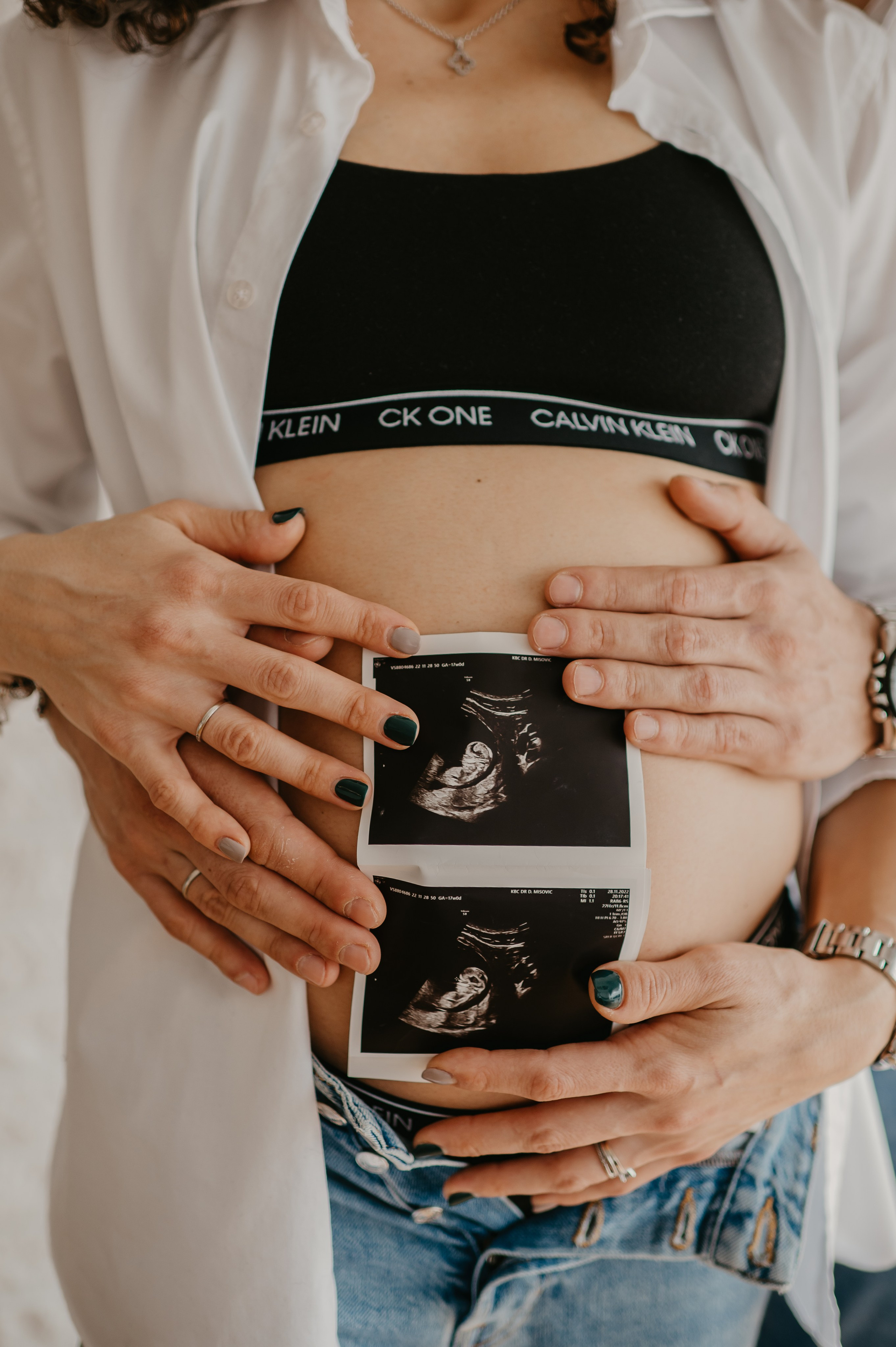 Aleksandra. Ana Sladojevic