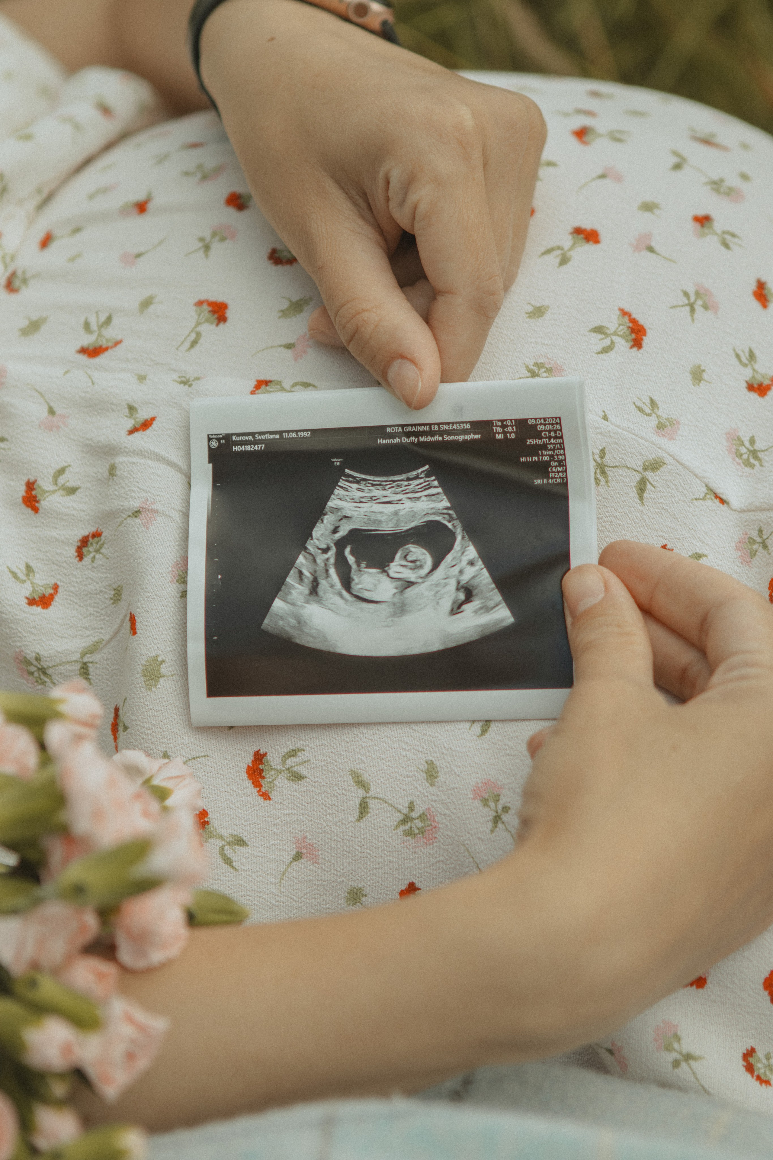 Expecting Pregnancy. Photographer Margarita Antonova in Naas, Co Kildare