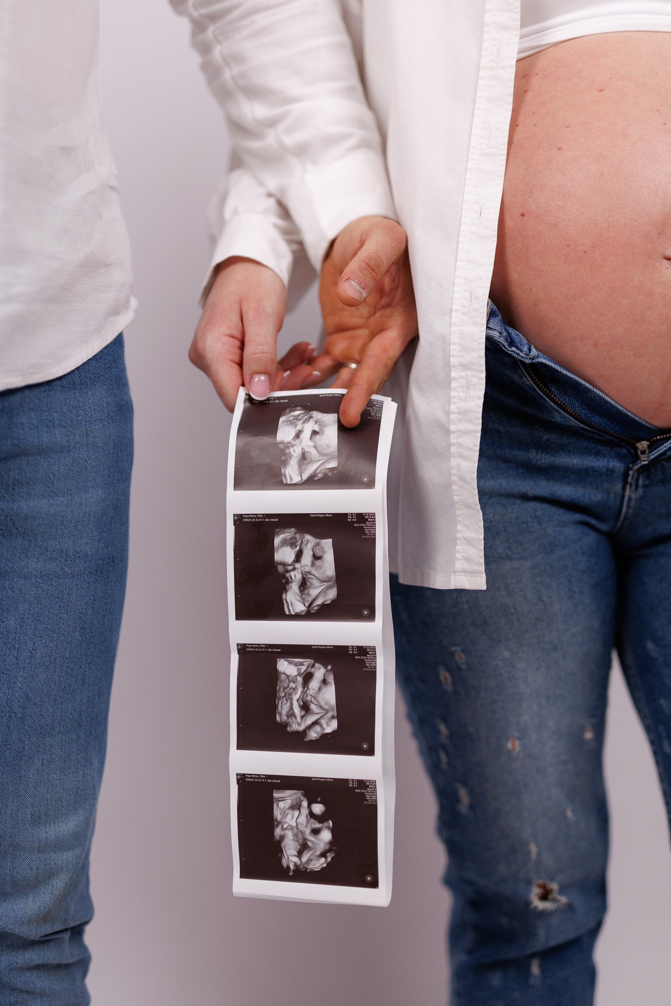Tilda & Alex | MaternityPhotoshoot. Alexandru Avram | Photographer