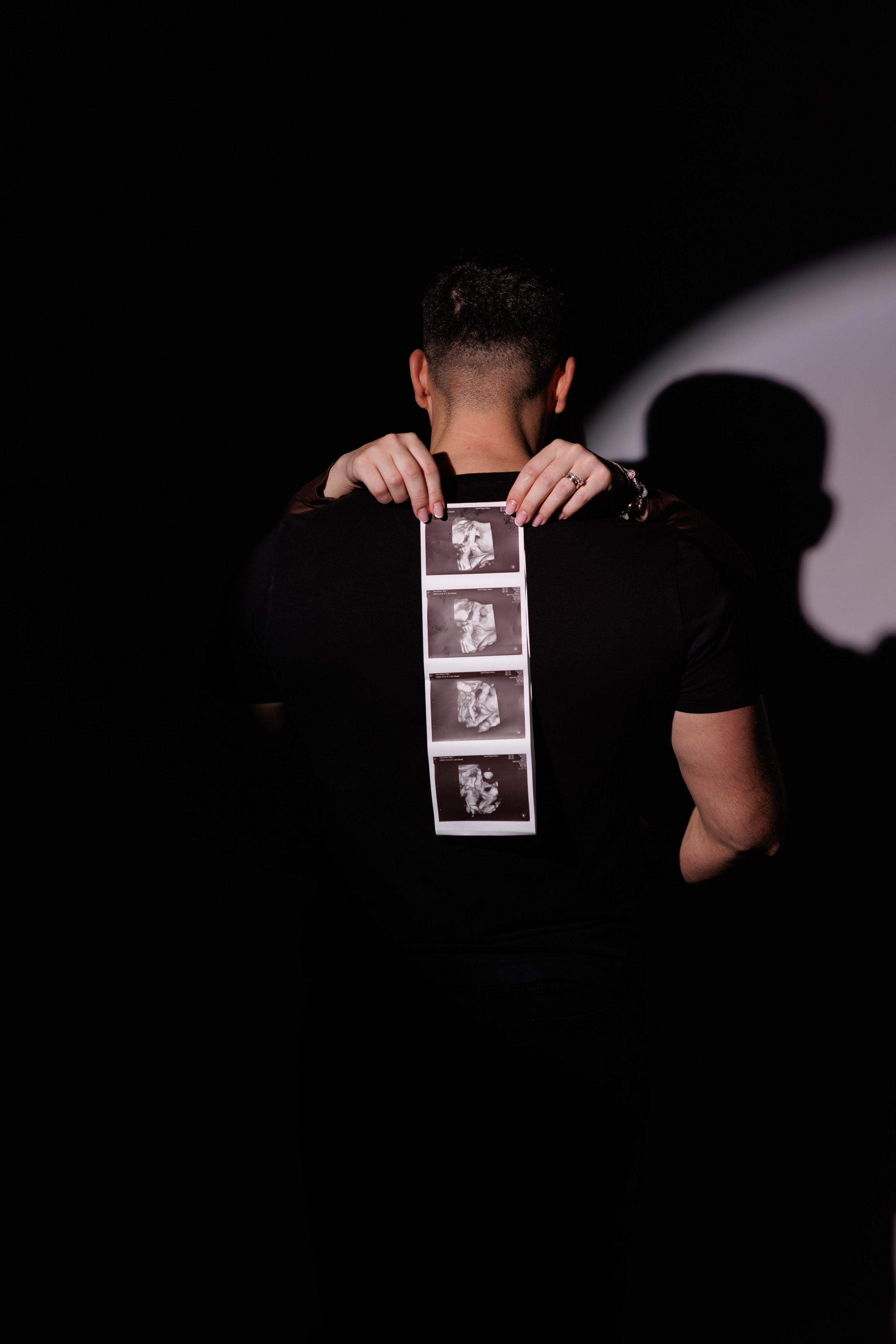 Tilda & Alex | MaternityPhotoshoot. Alexandru Avram | Photographer