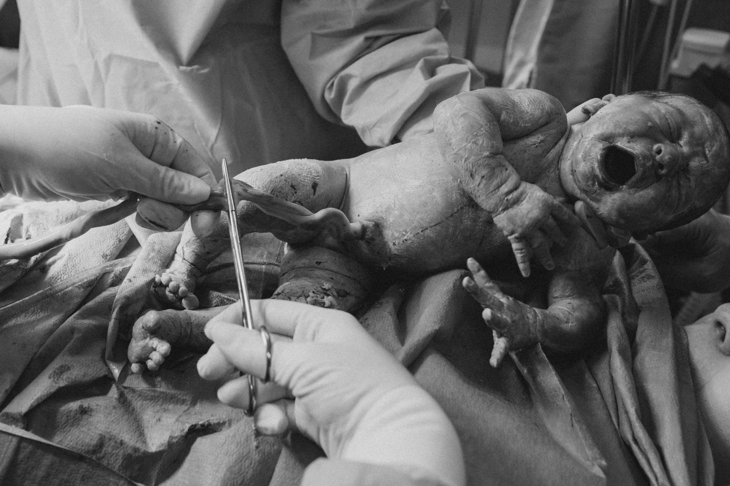 2024-11-25 | Parto — Manu. Lembrar não é só ver. É sentir de novo