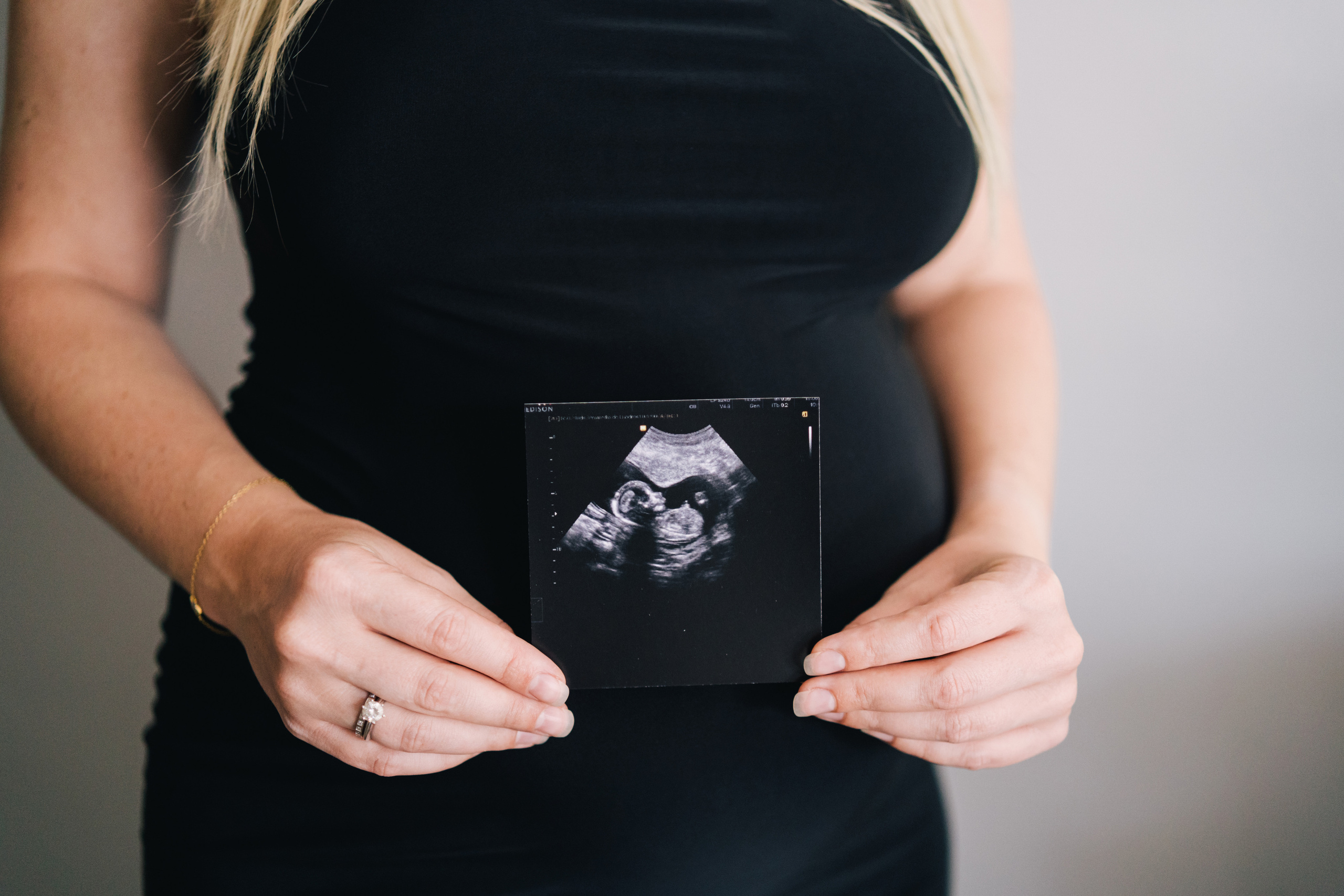 Maternity. Photographer Kristina Dorina