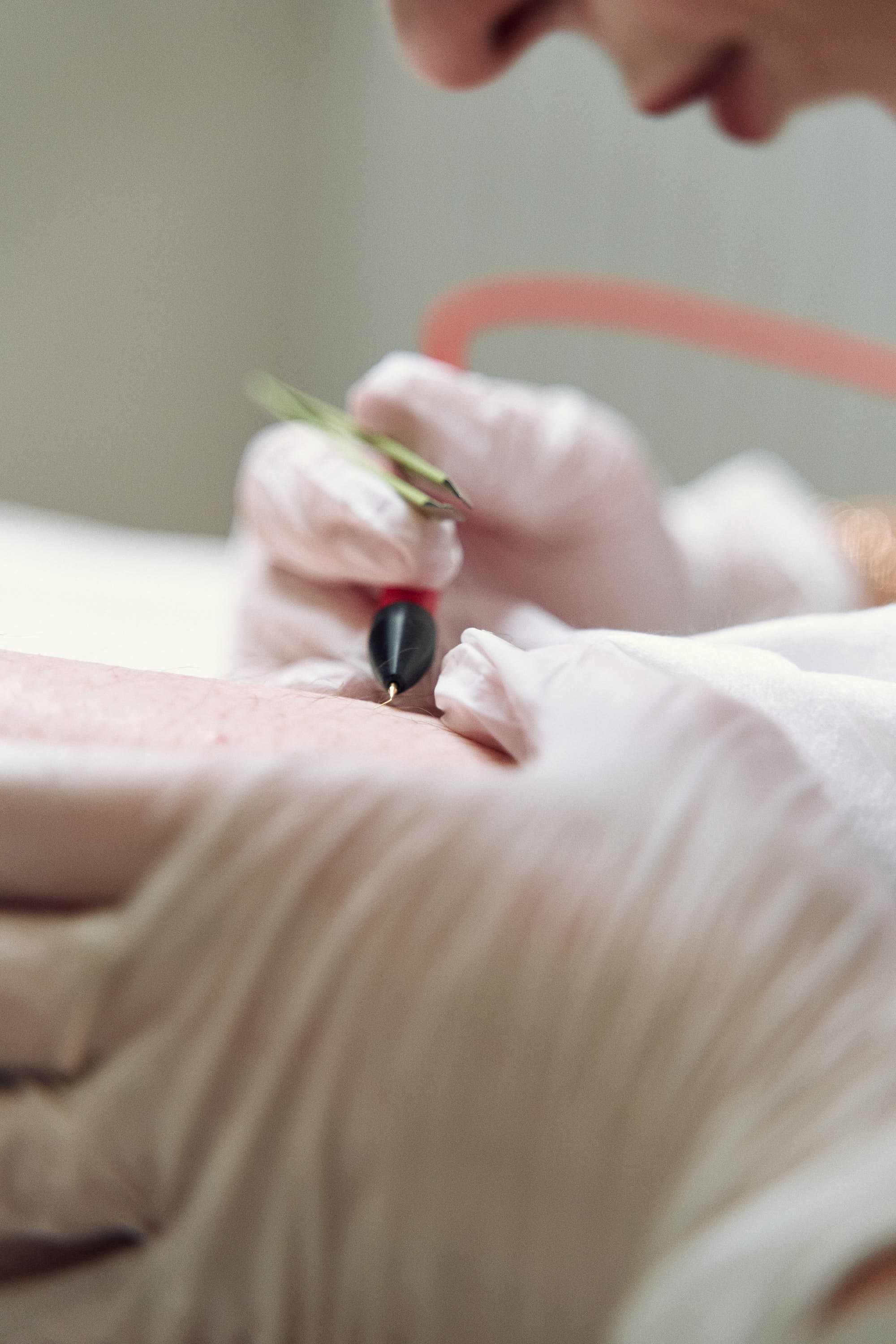 Fotografía y Vídeo Profesional para Depilación Eléctrica y Estética