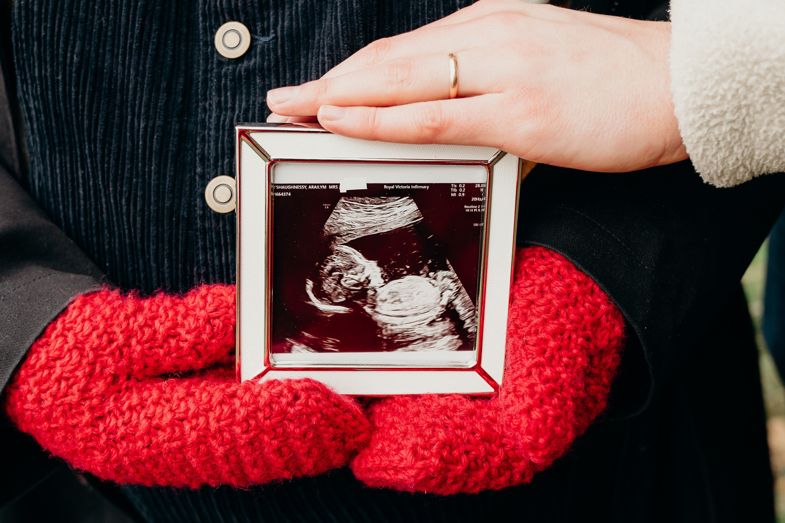 Maternity photographer Gosforth, Newcastle Upon Tyne, Northumberland. Outdoor maternity lifestyle photography