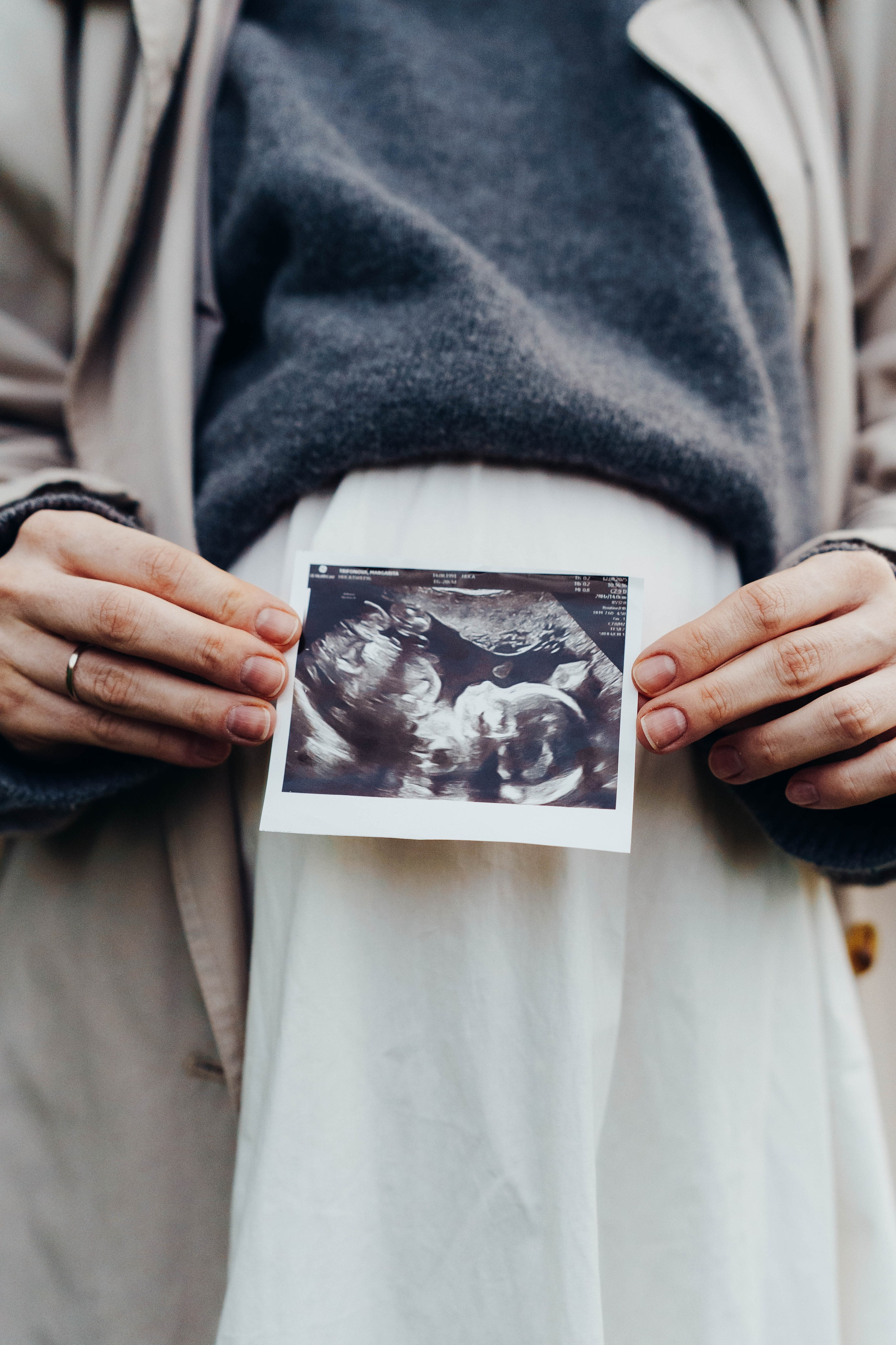 Рита, Саша. Family photographer in Oviedo — Yana Razina