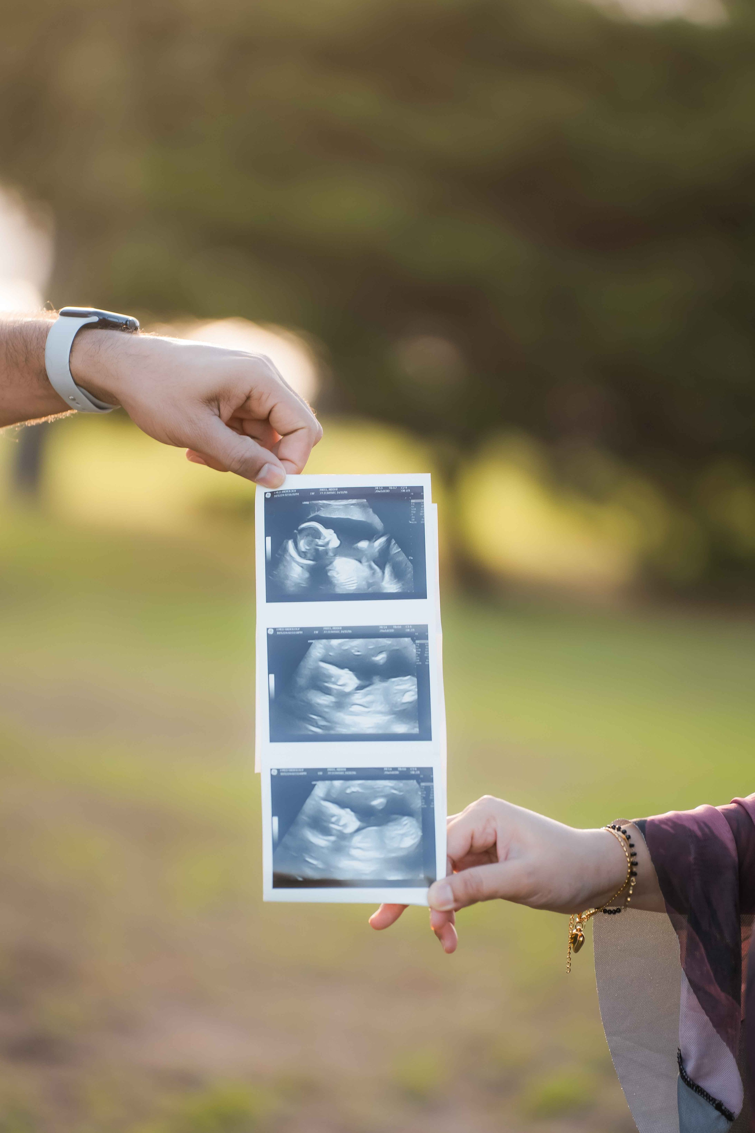 Maternity photographer Berwick, Brighton pregnancy portraits, Frankston maternity sessions, Caulfield fine art maternity.