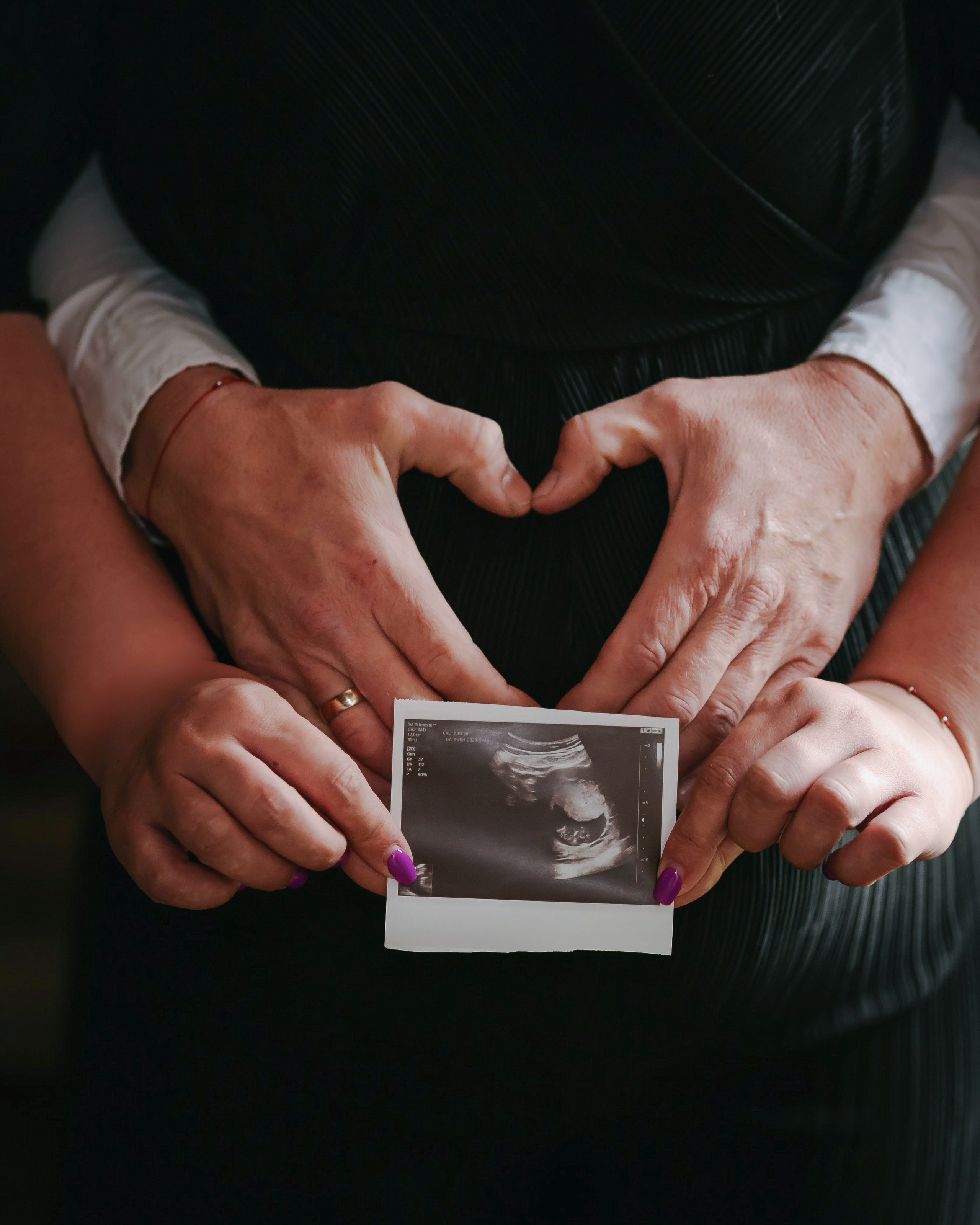 Aidos nėščioji fotosesija. Rokas Baranauskas fotografija