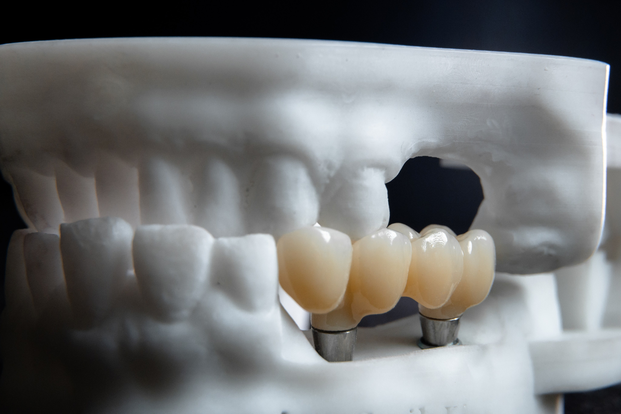 Smileline laboratory. 