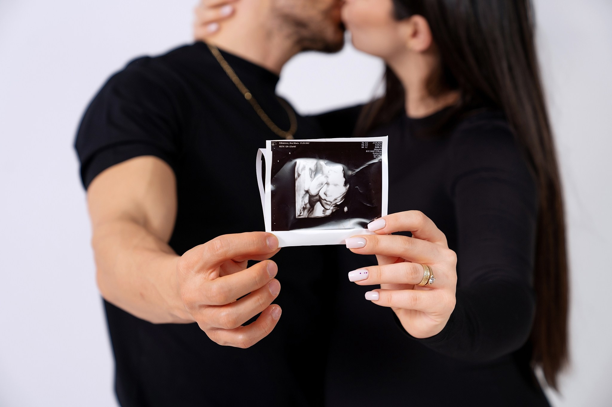 Ana & Andrei (sedinta foto de maternitate). Fotograf evenimente. Fotograf nunta. Fotograf Botez. Mihaela Savu