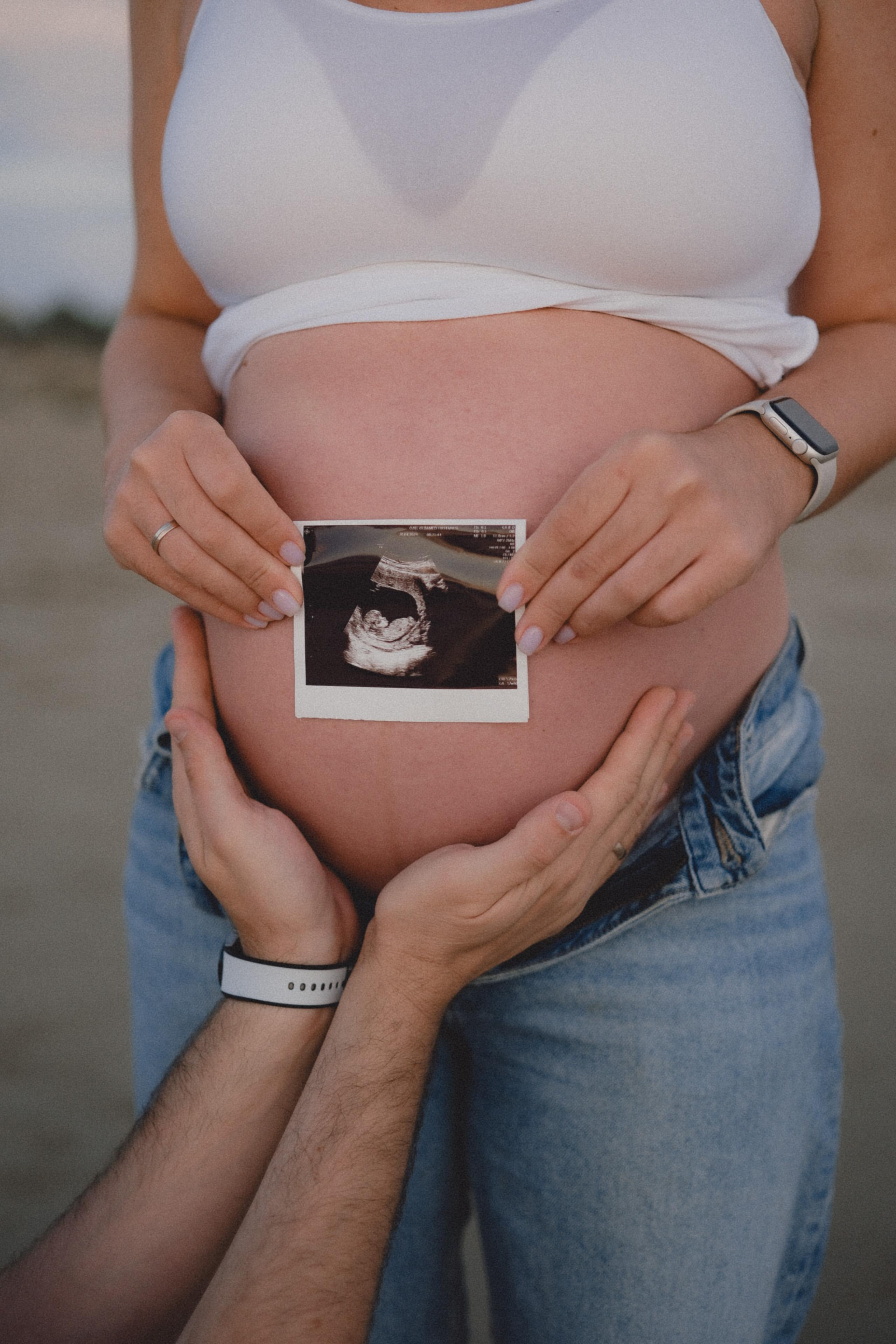 В ожидании малышки. Lifestyle фотограф в Турции: Ташуджу, Силифке, Мерсин