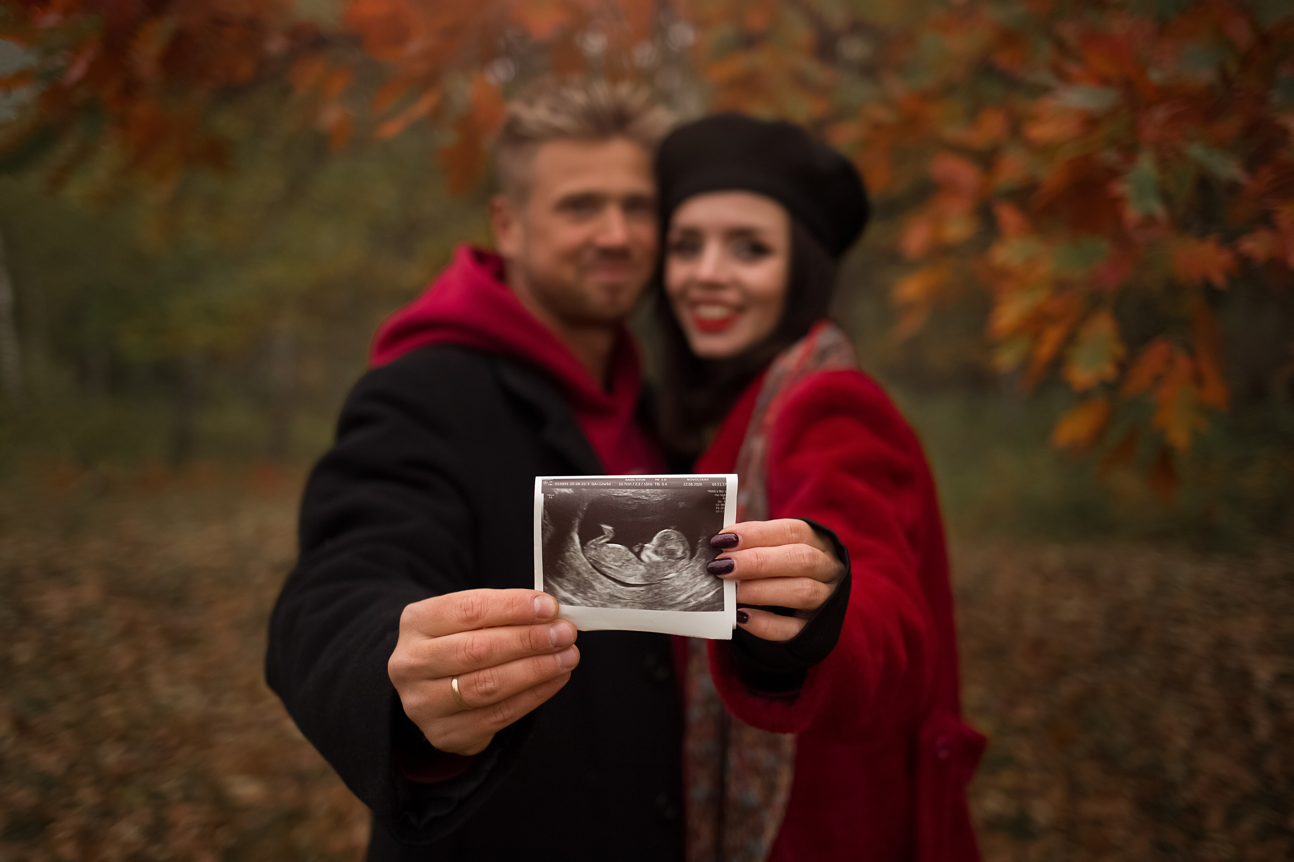 Мальчик или девочка. Семейный и детский фотограф в Вильнюсе Светлана Наумова