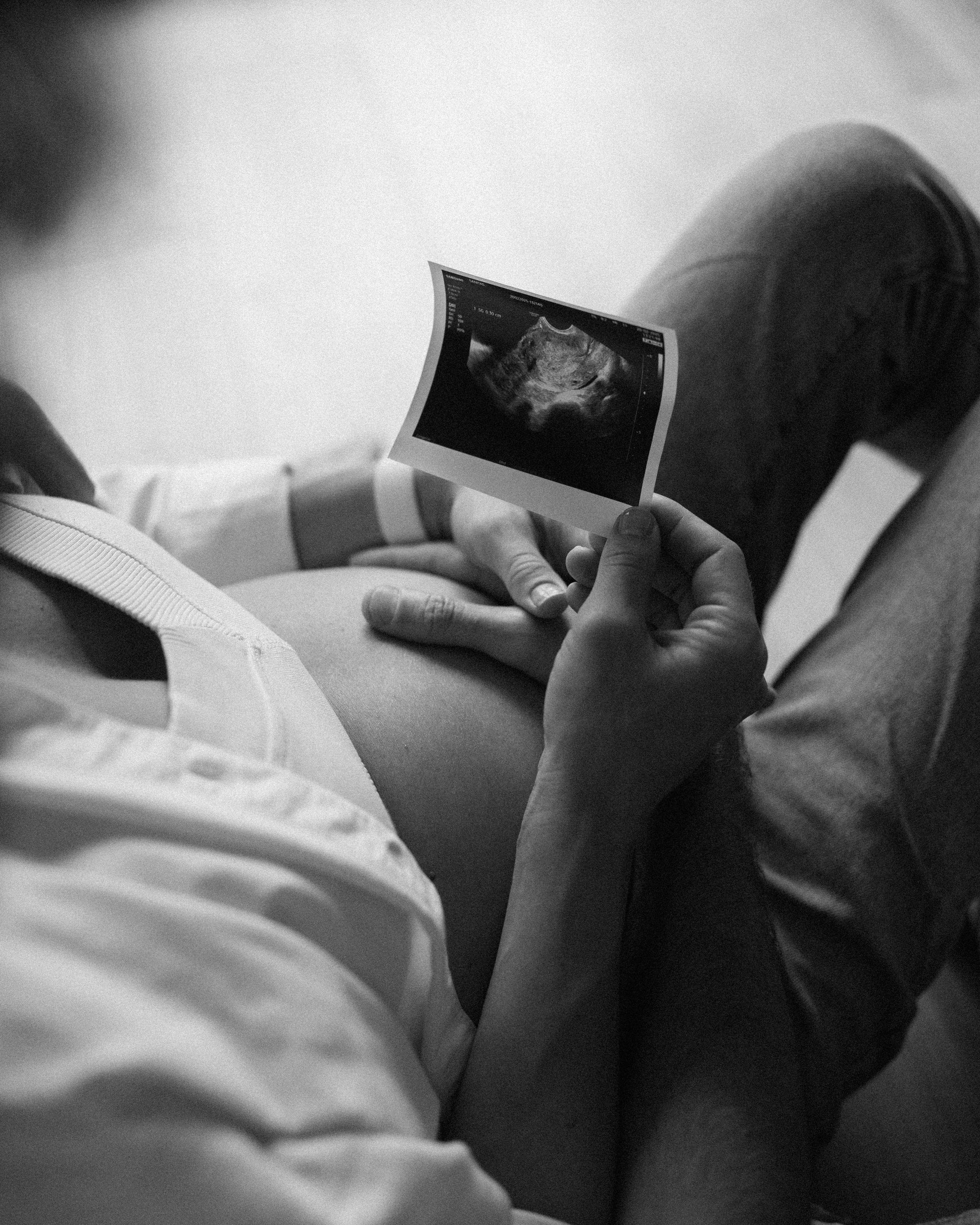 Candid pregnancy photoshoot in the park. Photographer in Madrid, Spain. Alyona Belyaninova