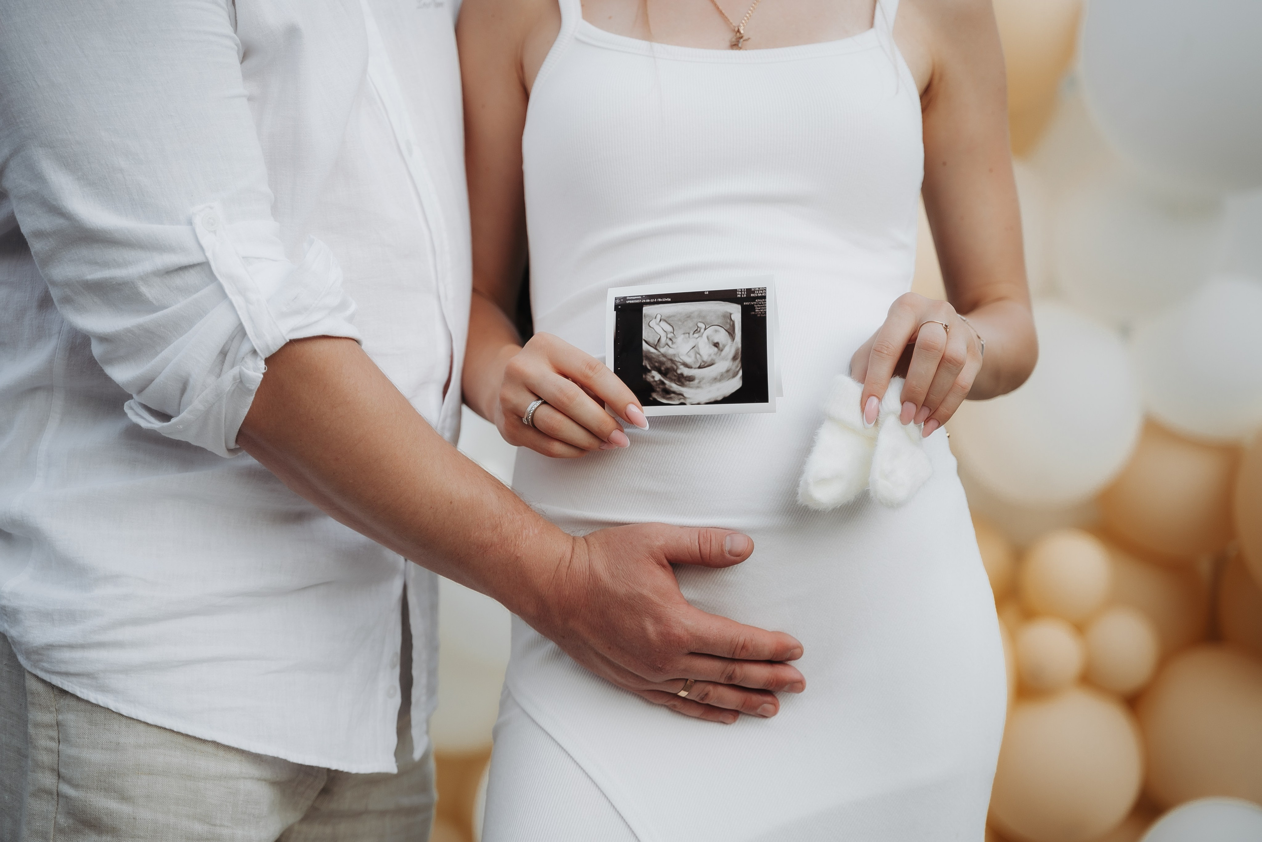 Gender Party. ST.PHOTO13