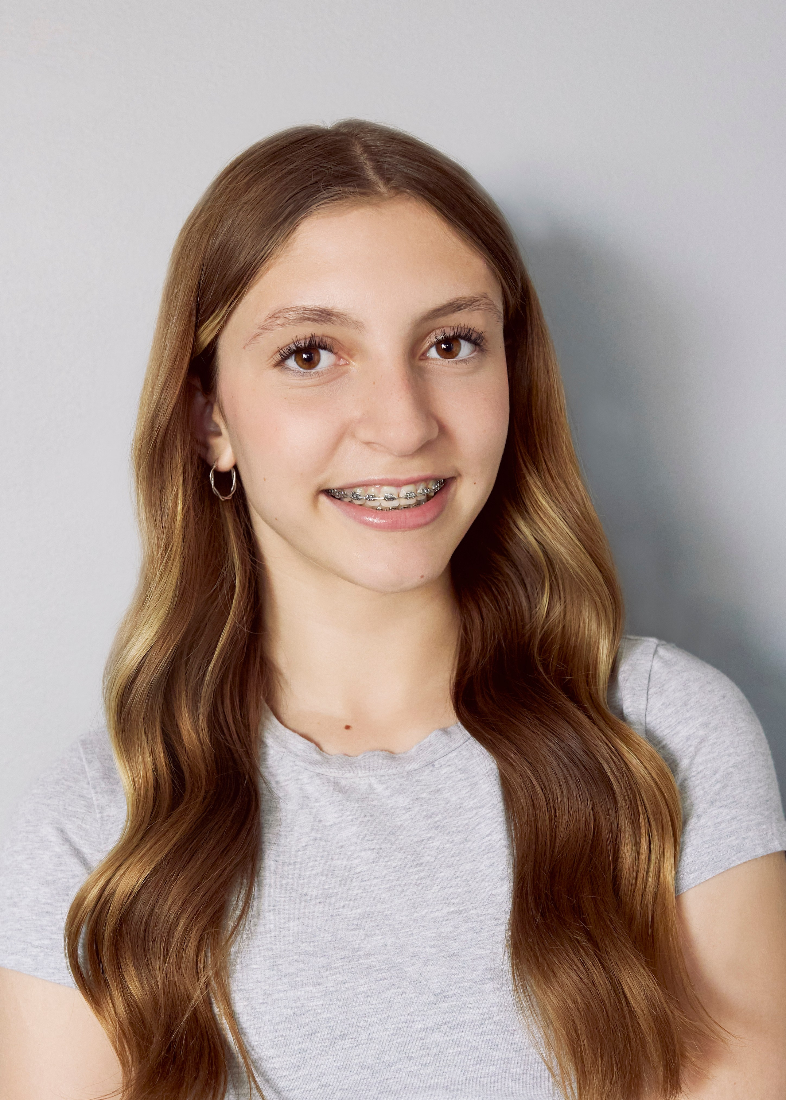 headshot of young blond dancer with braces 
