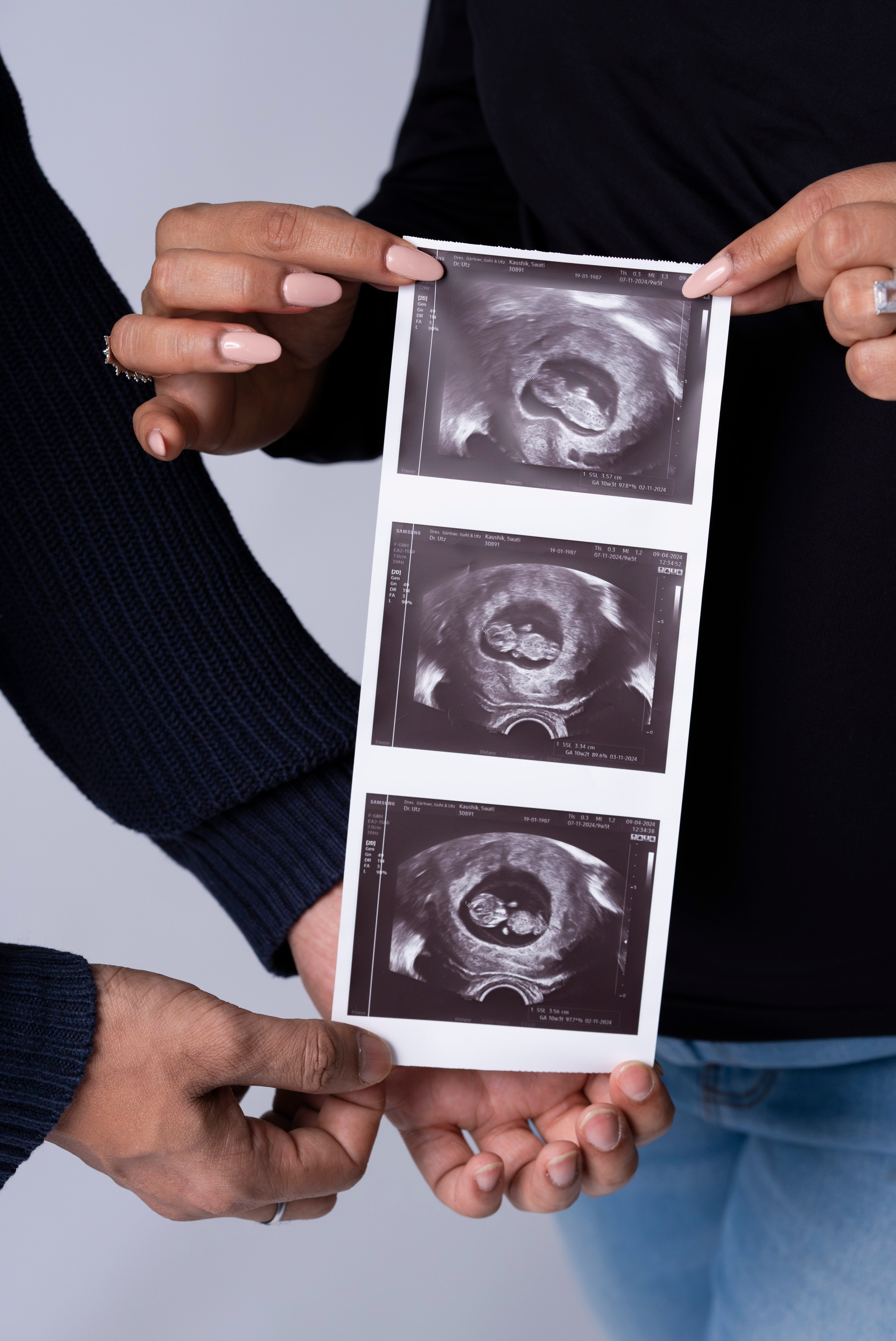 BABYBAUCH. Fotostudio in Metzingen