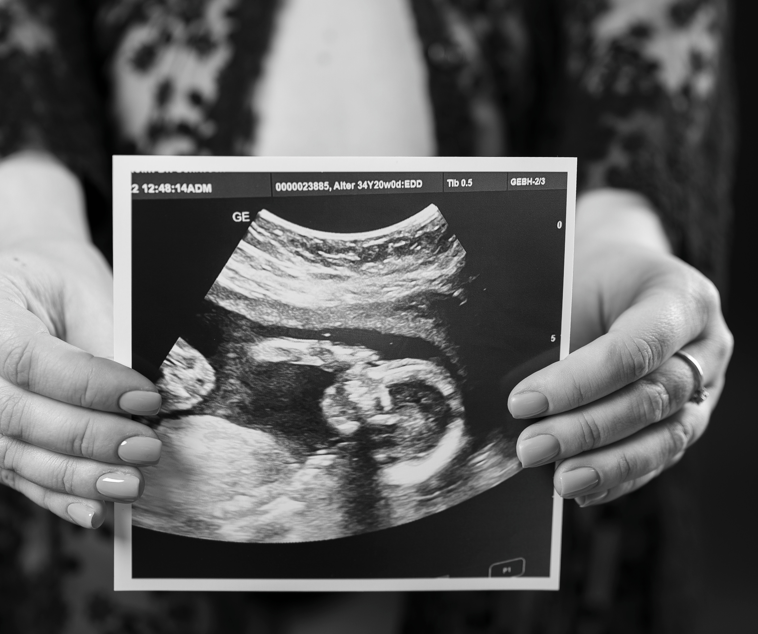 Студийная съёмка беременность. Familien, Lifestyle und Portrait Fotografin in Trier, Luxembourg