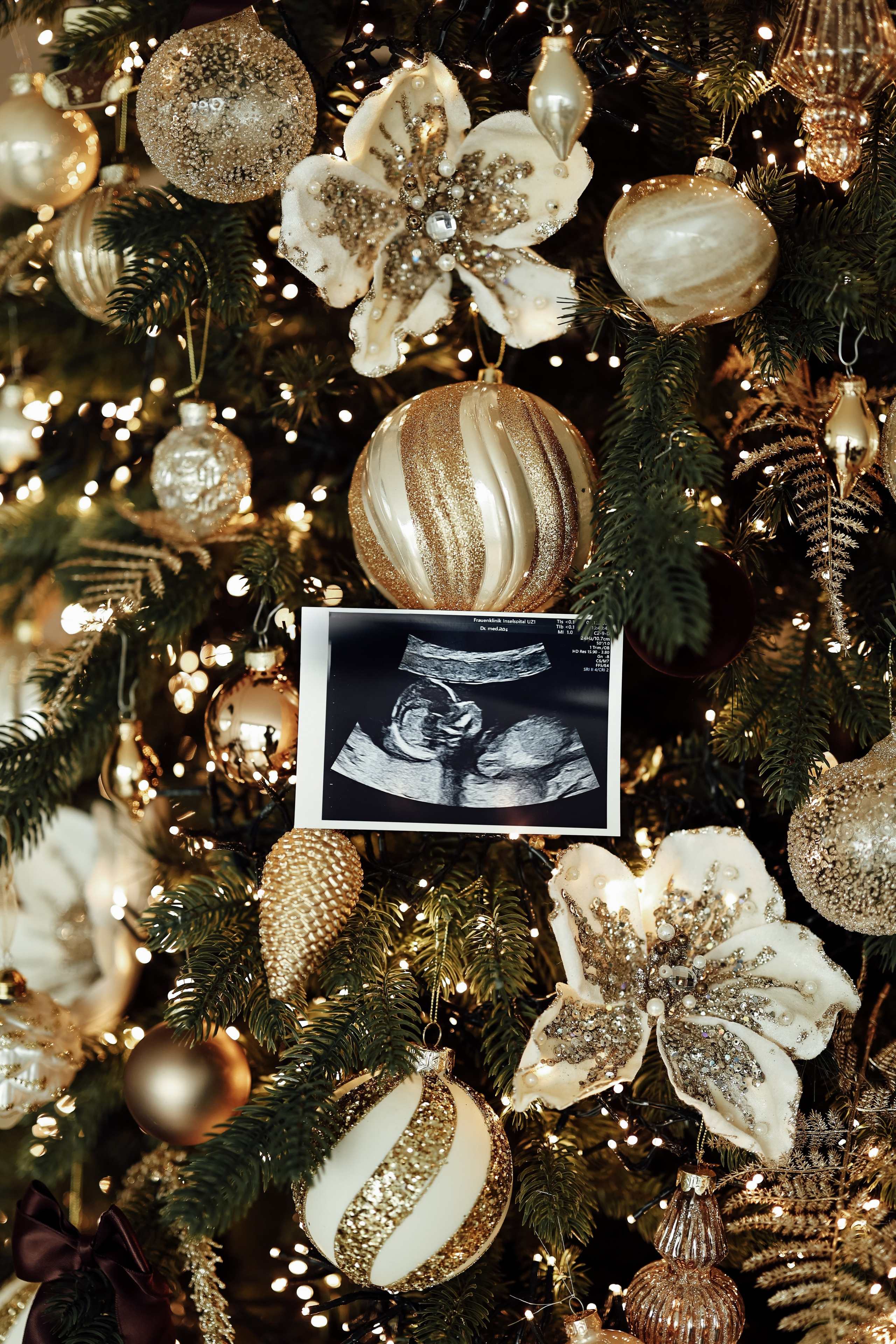 Schwangerschaft. Familienfotografin in Bern, Schweiz