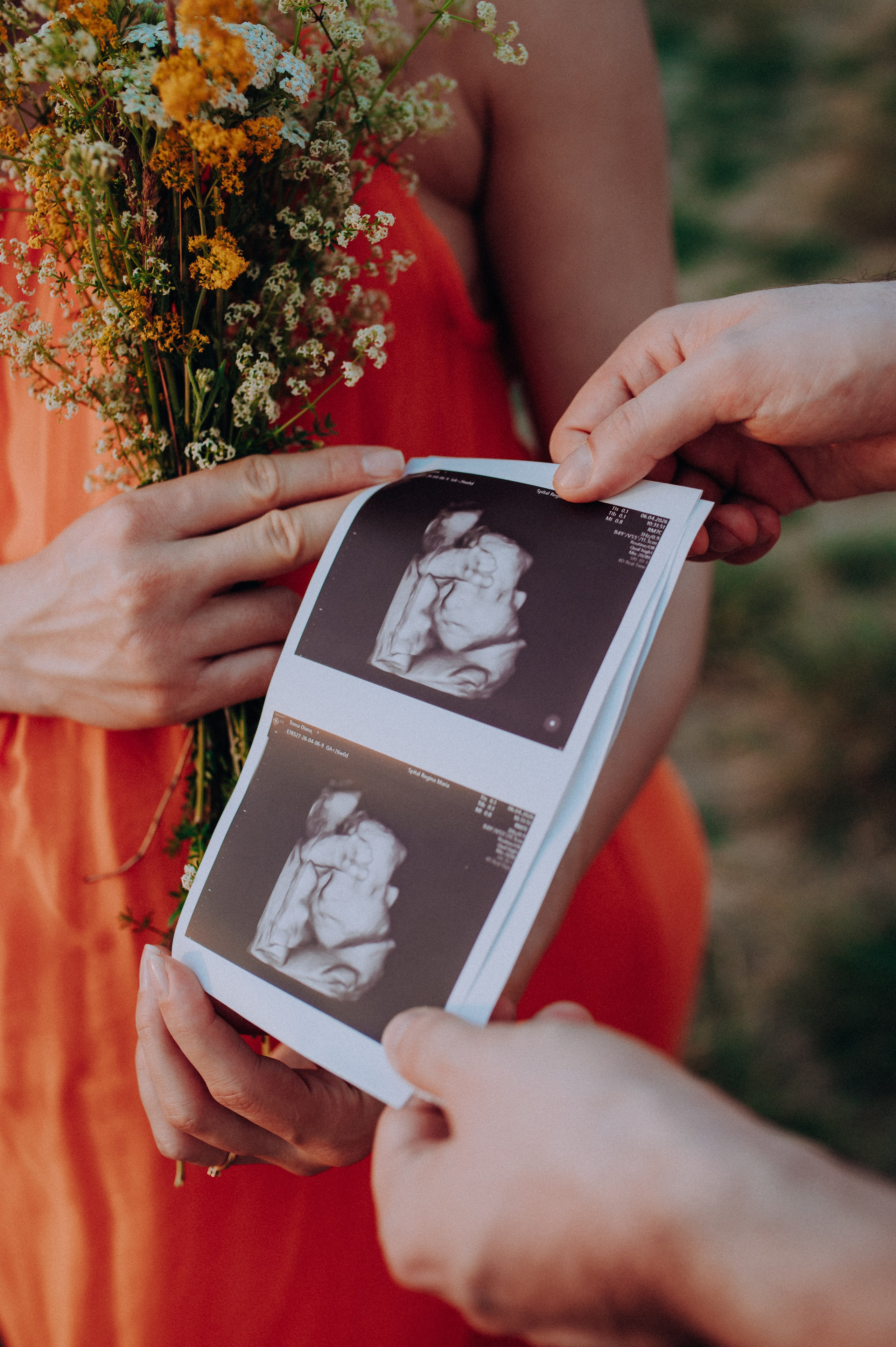 Ședință Foto Maternitate Cluj-Napoca | Diana & Dan