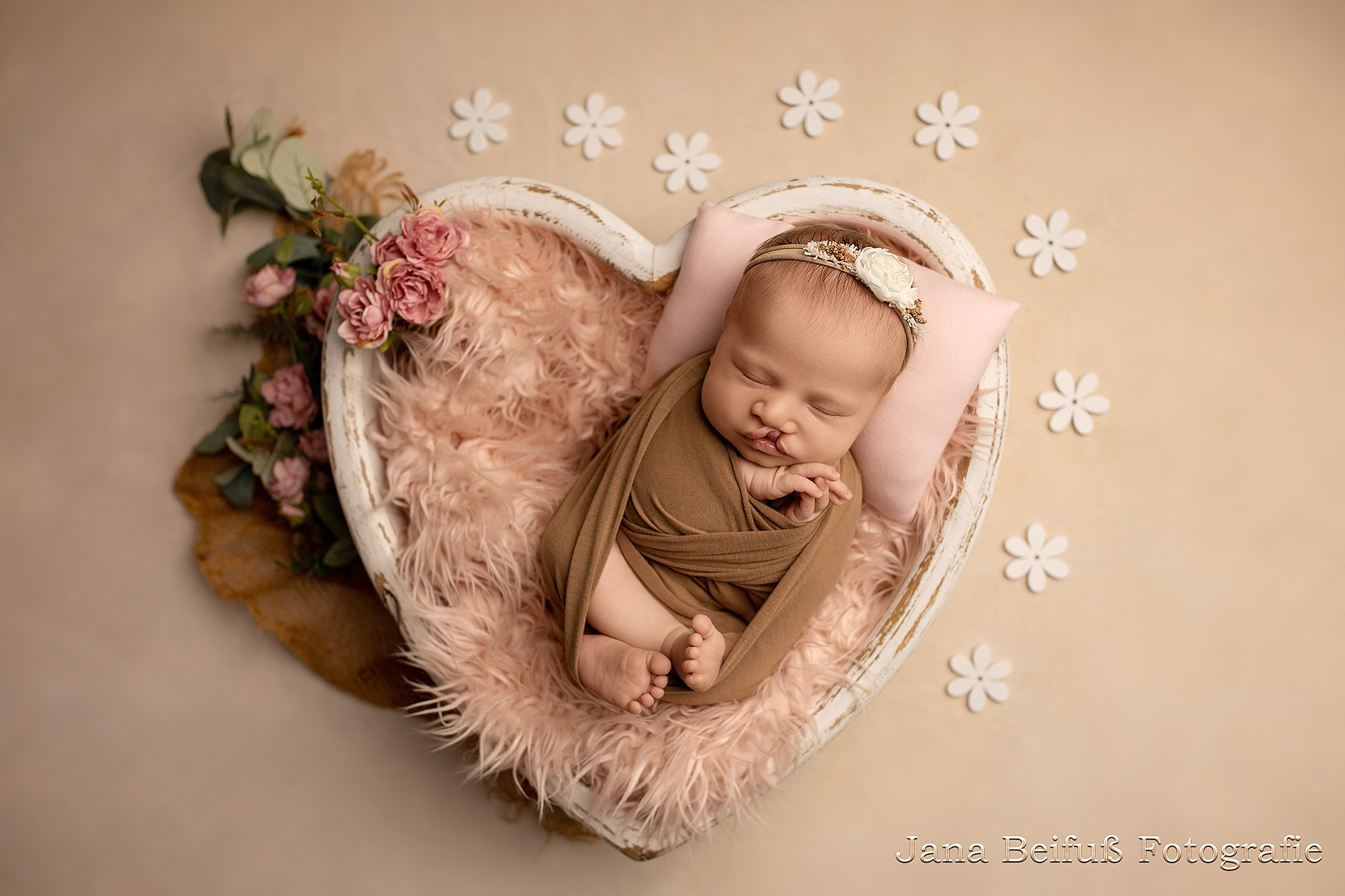 Neugeborenenshooting Weißenhorn, Neugeborenenshooting Ulm, Babyfotograf Ulm, Babyfotograf Senden, Babyfotograf Neu-Ulm, Jana Beifuß Fotografie, Familienfotos, Liebe, Geduld, Neugeborenenfotos weissenhorn, Pfaffenhofen a. d. Roth, Gaumenspalte, Gaumenlippenspalte