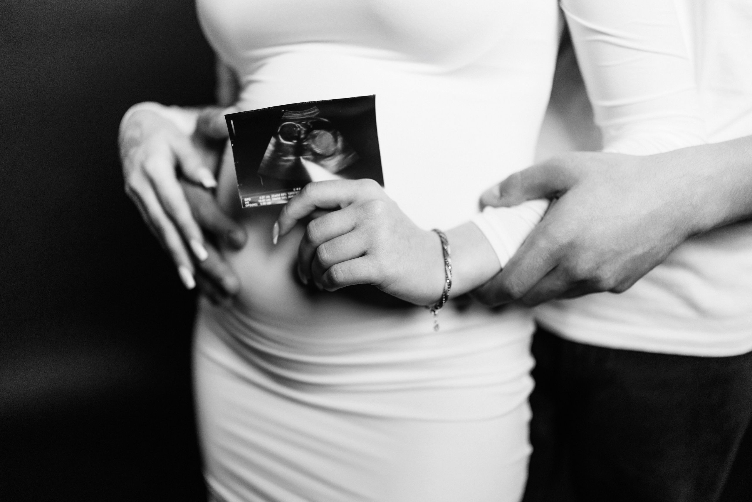 Gender Party 💗💙. Anna Rudnichenko Fotograf Szczecin / Анна Рудніченко Фотограф Щецин